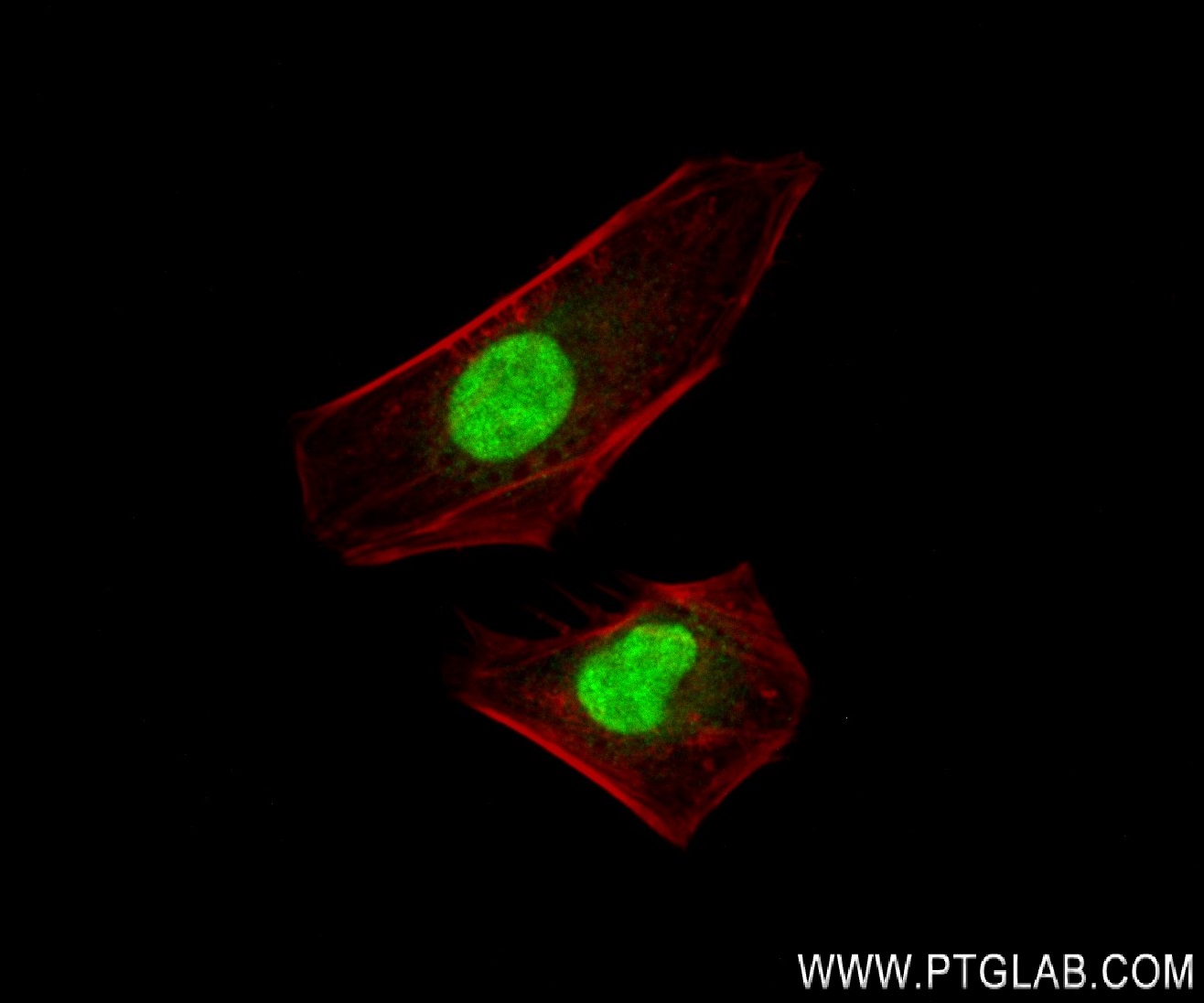 Immunofluorescence (IF) / fluorescent staining of HeLa cells using MAZ Recombinant antibody (82852-3-RR)