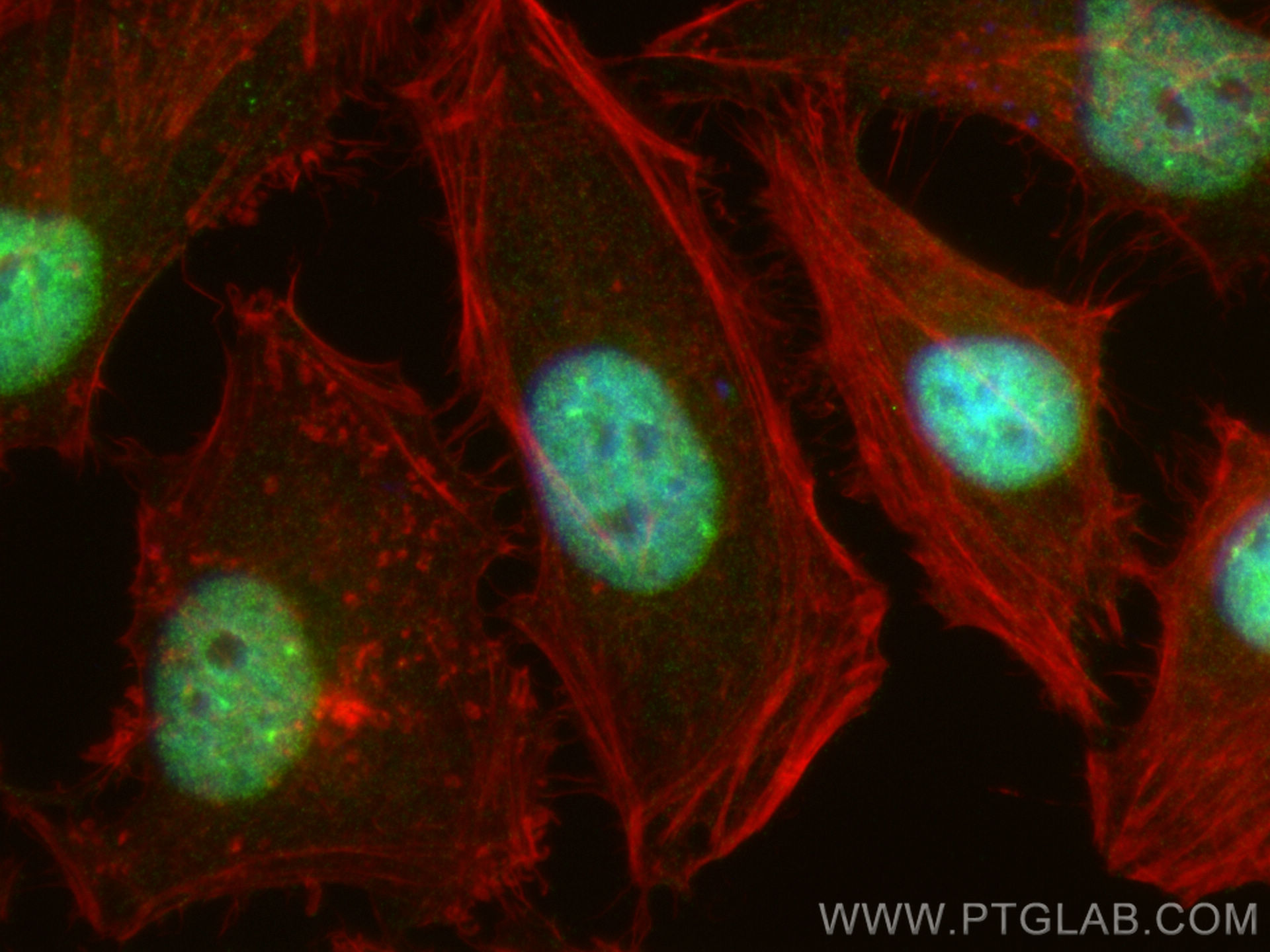 Immunofluorescence (IF) / fluorescent staining of HeLa cells using MBD1 Polyclonal antibody (29998-1-AP)