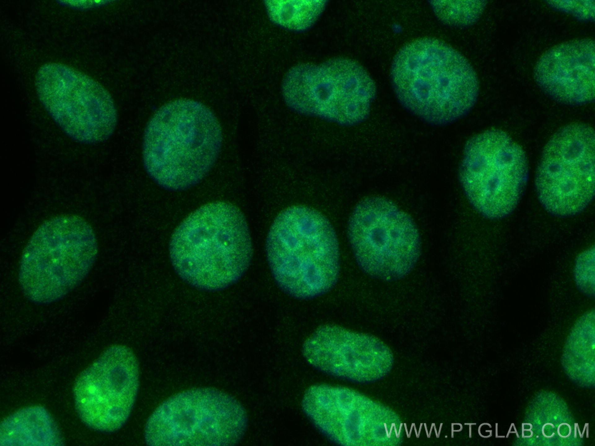 Immunofluorescence (IF) / fluorescent staining of MCF-7 cells using MBD1 Polyclonal antibody (29998-1-AP)