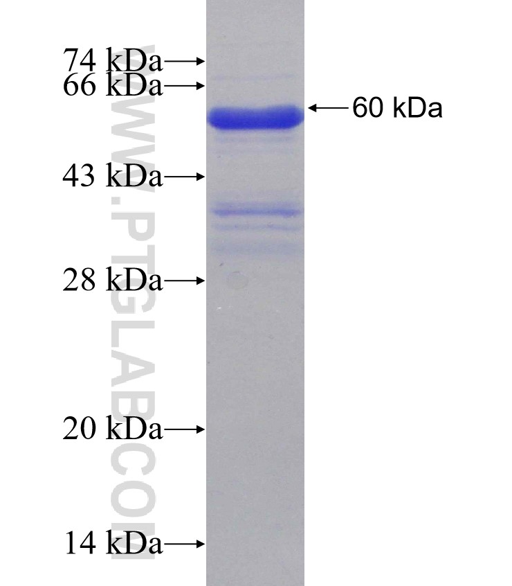 MBD1 fusion protein Ag31424 SDS-PAGE