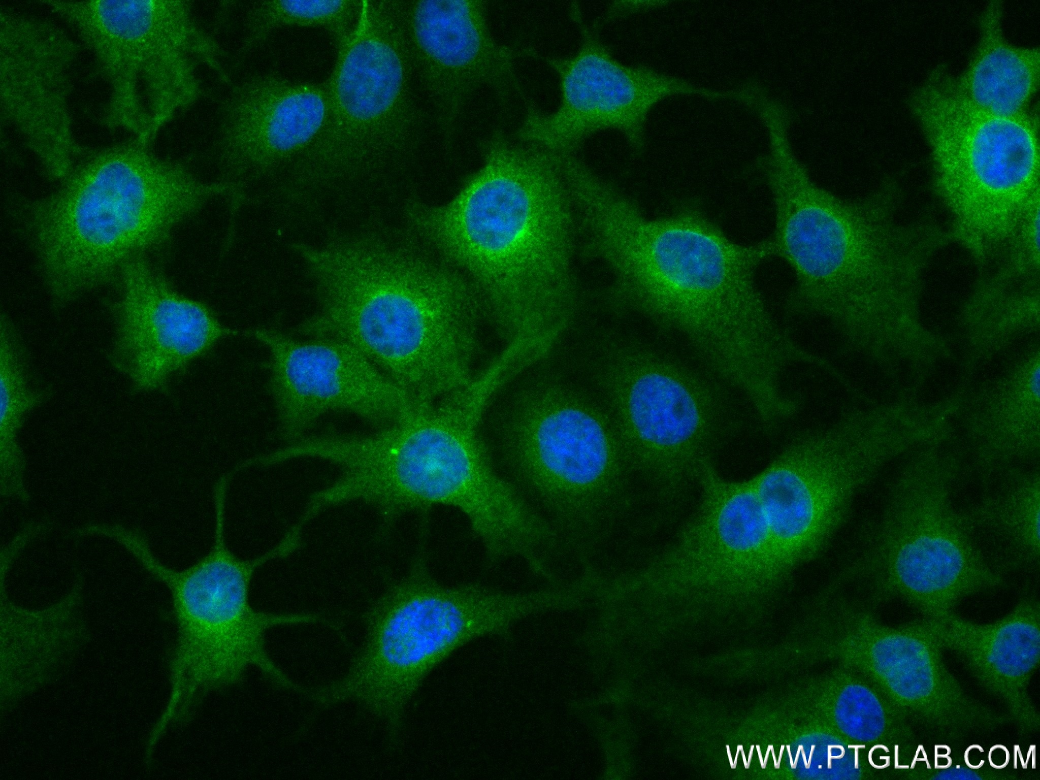 Immunofluorescence (IF) / fluorescent staining of HuH-7 cells using MBOAT7 Recombinant antibody (83546-3-RR)