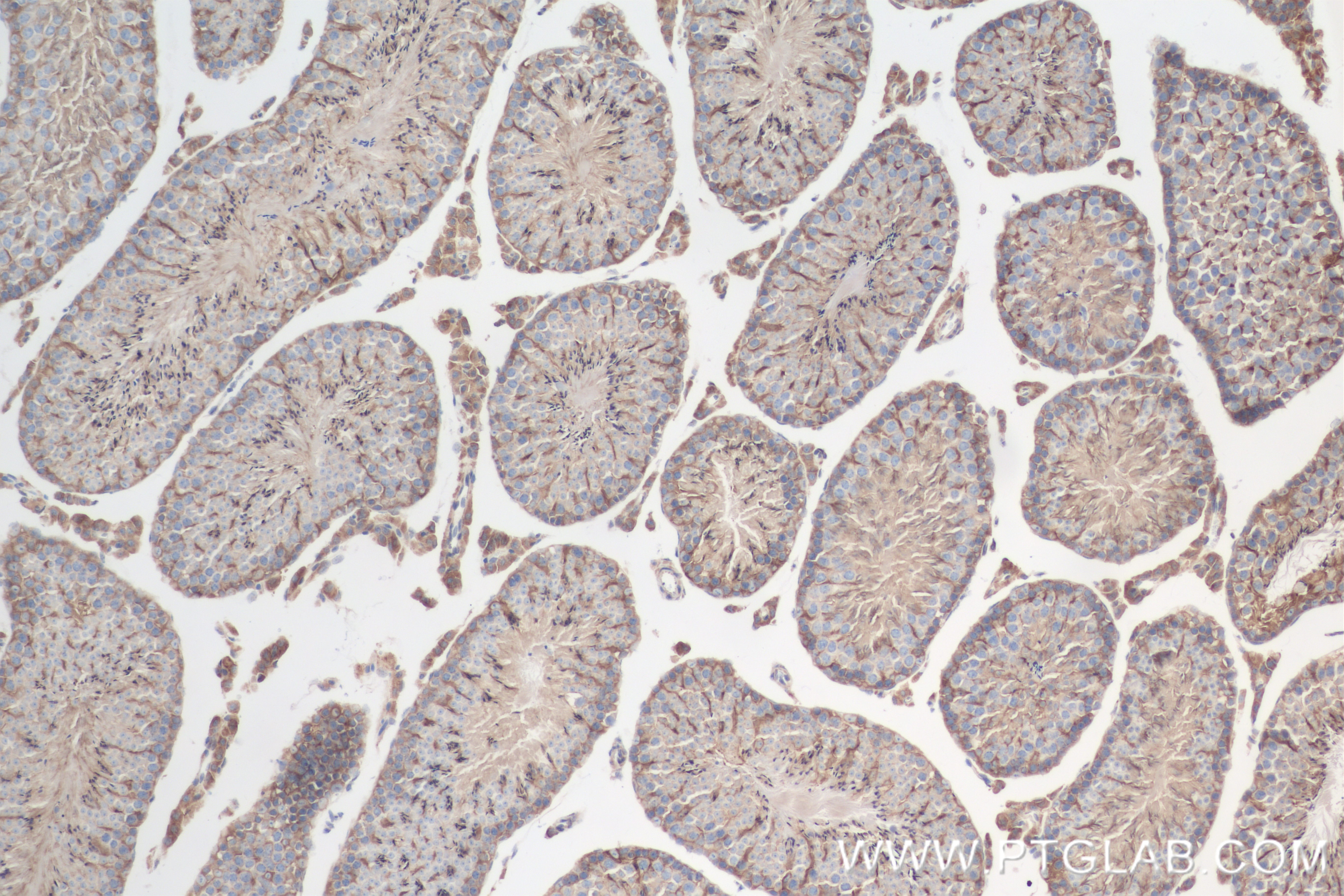 Immunohistochemistry (IHC) staining of mouse testis tissue using MBOAT7 Recombinant antibody (83546-3-RR)