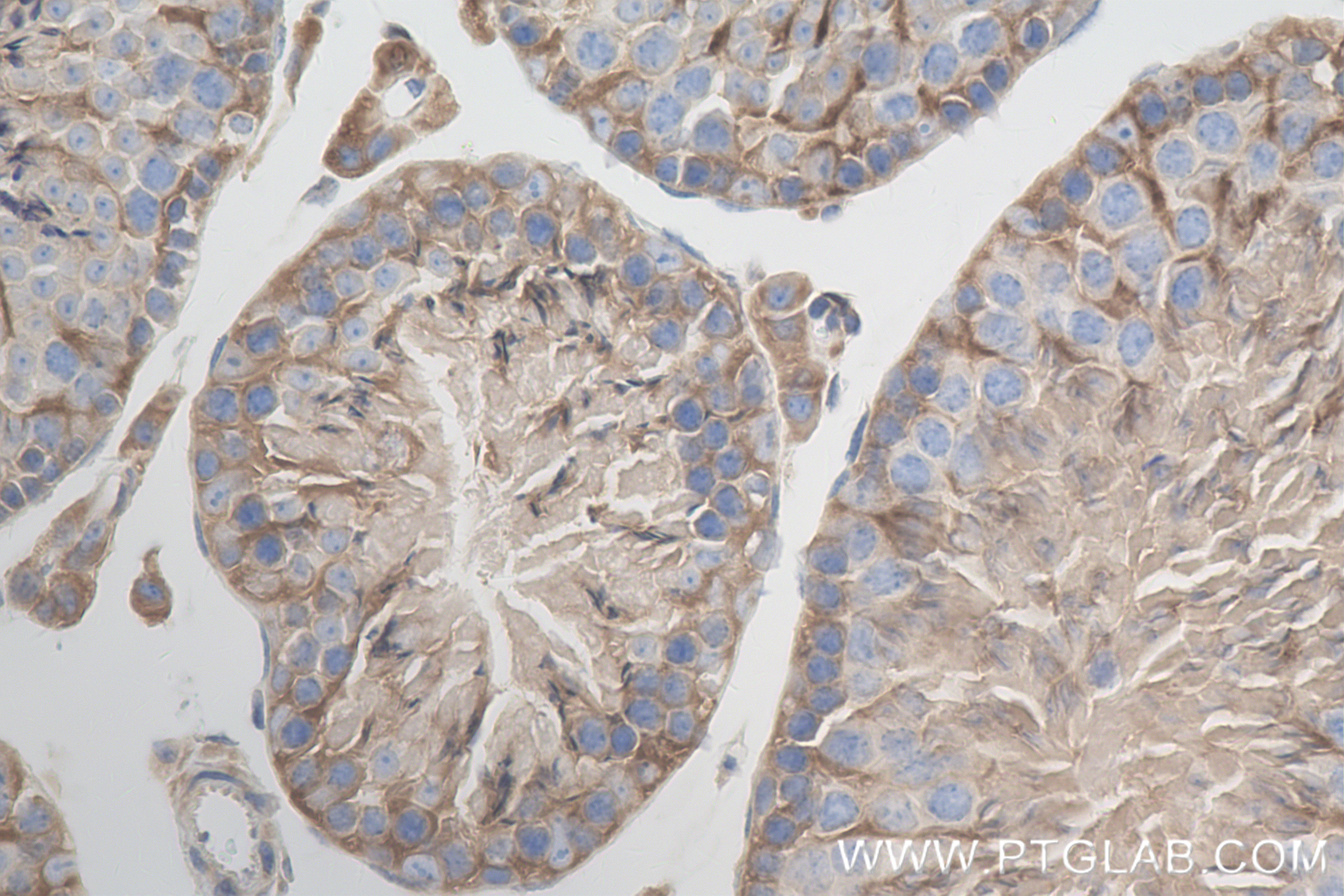 Immunohistochemistry (IHC) staining of mouse testis tissue using MBOAT7 Recombinant antibody (83546-3-RR)