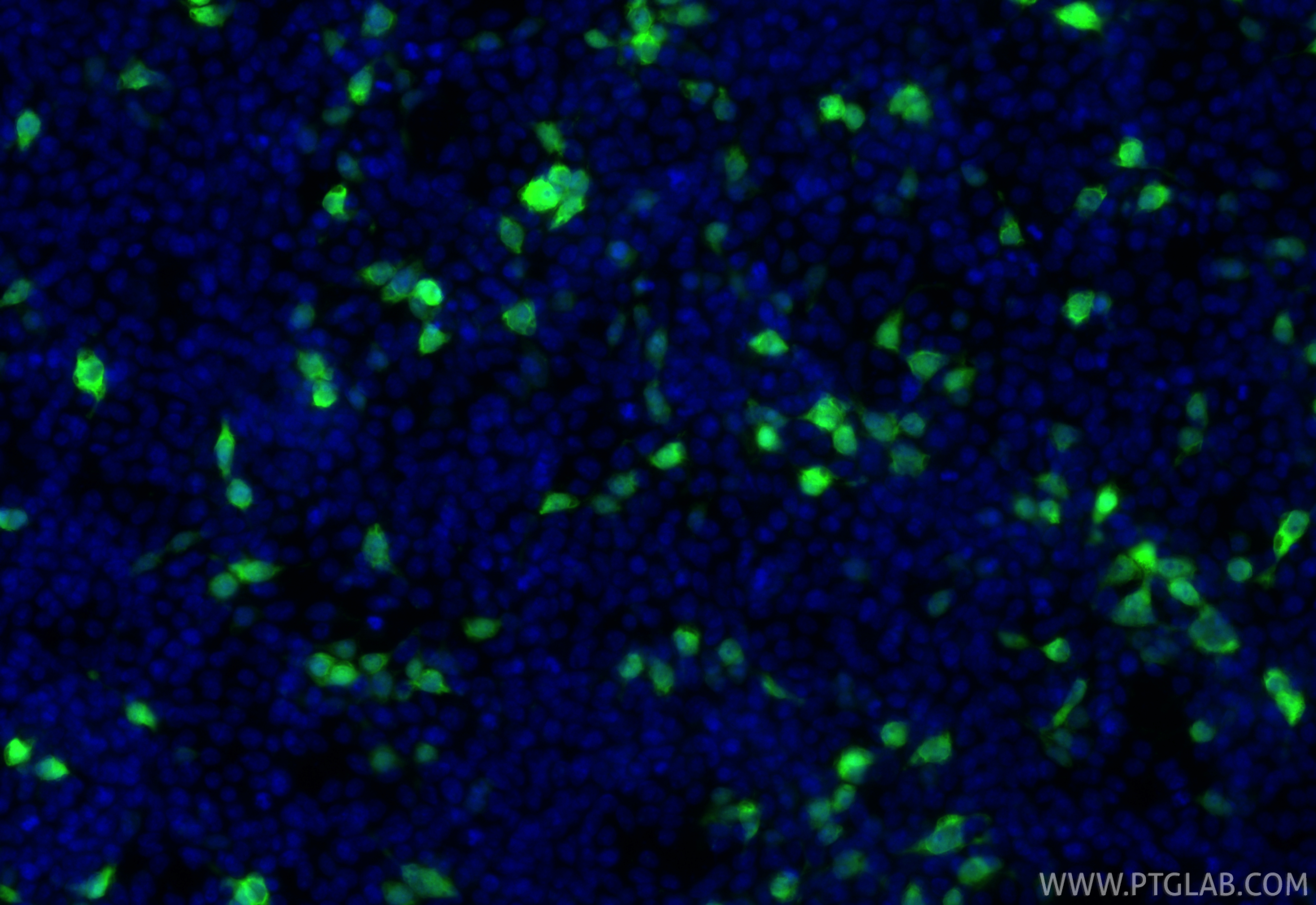Immunofluorescence (IF) / fluorescent staining of Transfected HEK-293 cells using CoraLite® Plus 488-conjugated MBP tag Monoclonal a (CL488-66003)