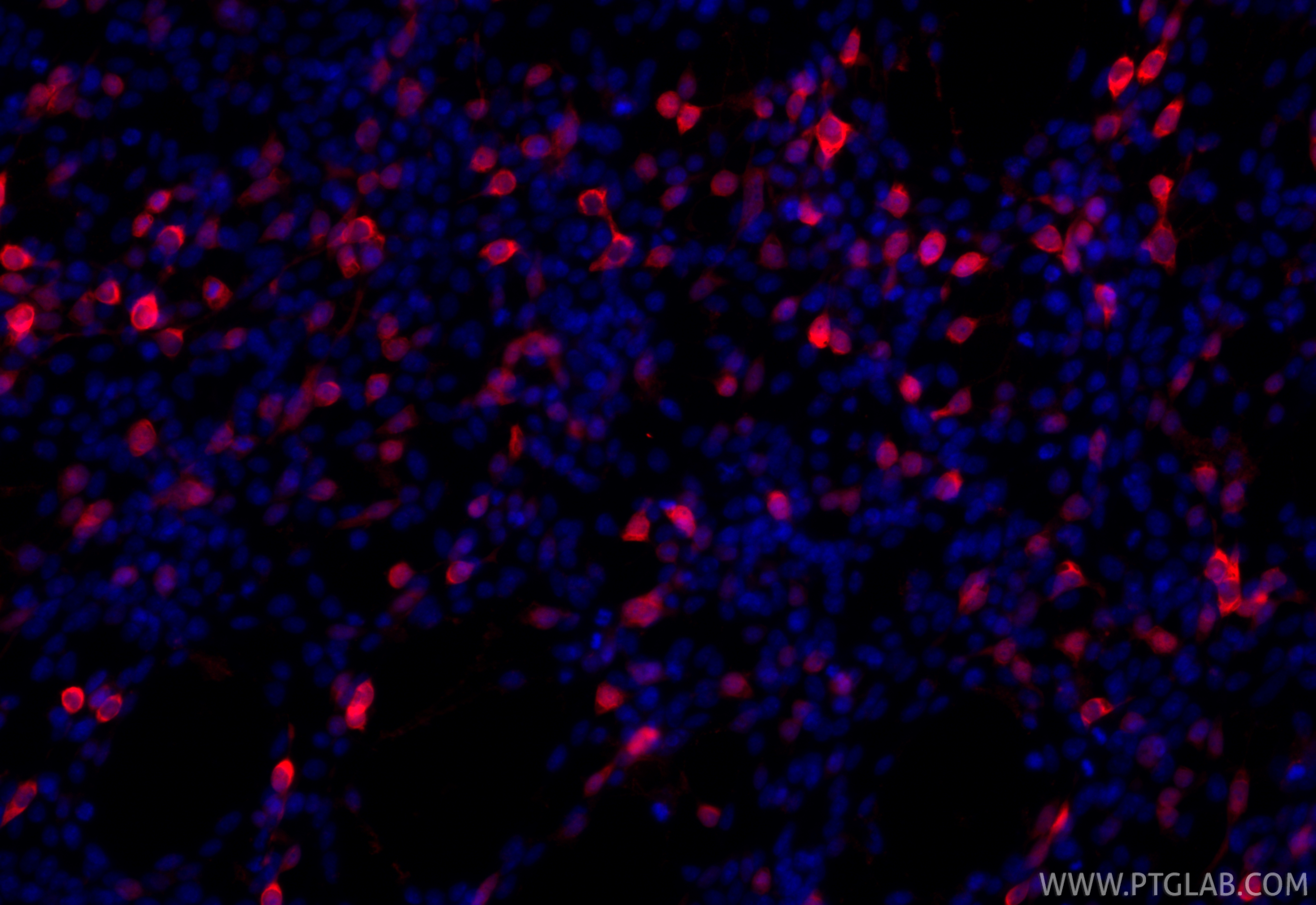 Immunofluorescence (IF) / fluorescent staining of Transfected HEK-293 cells using CoraLite®594-conjugated MBP tag Monoclonal antibod (CL594-66003)
