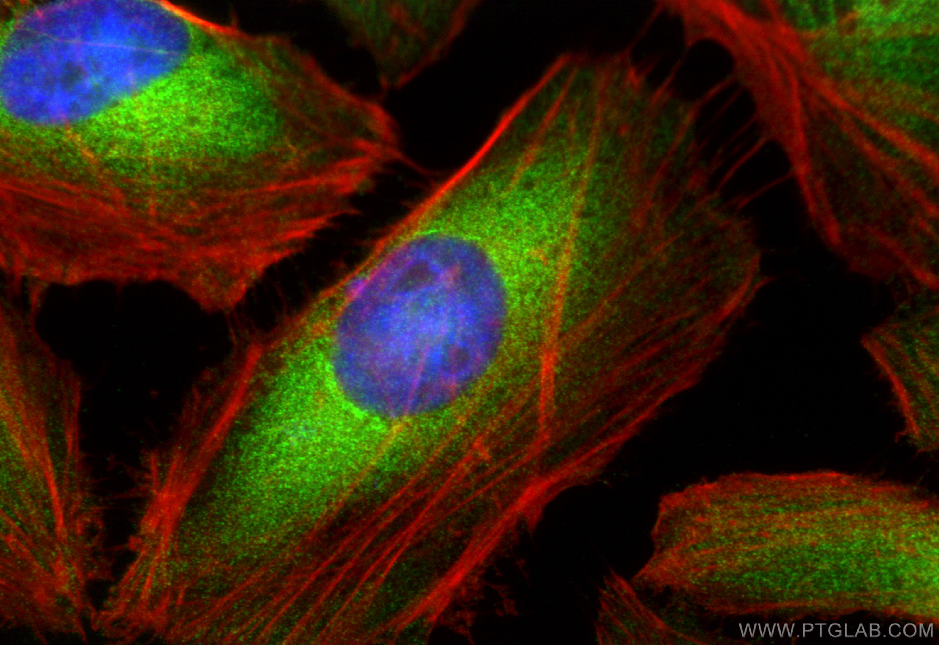 Immunofluorescence (IF) / fluorescent staining of HeLa cells using MCC Polyclonal antibody (11525-1-AP)