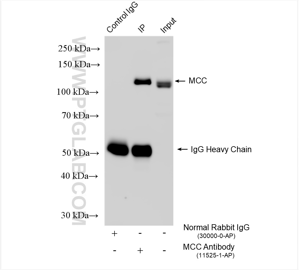 Immunoprecipitation (IP) experiment of HeLa cells using MCC Polyclonal antibody (11525-1-AP)