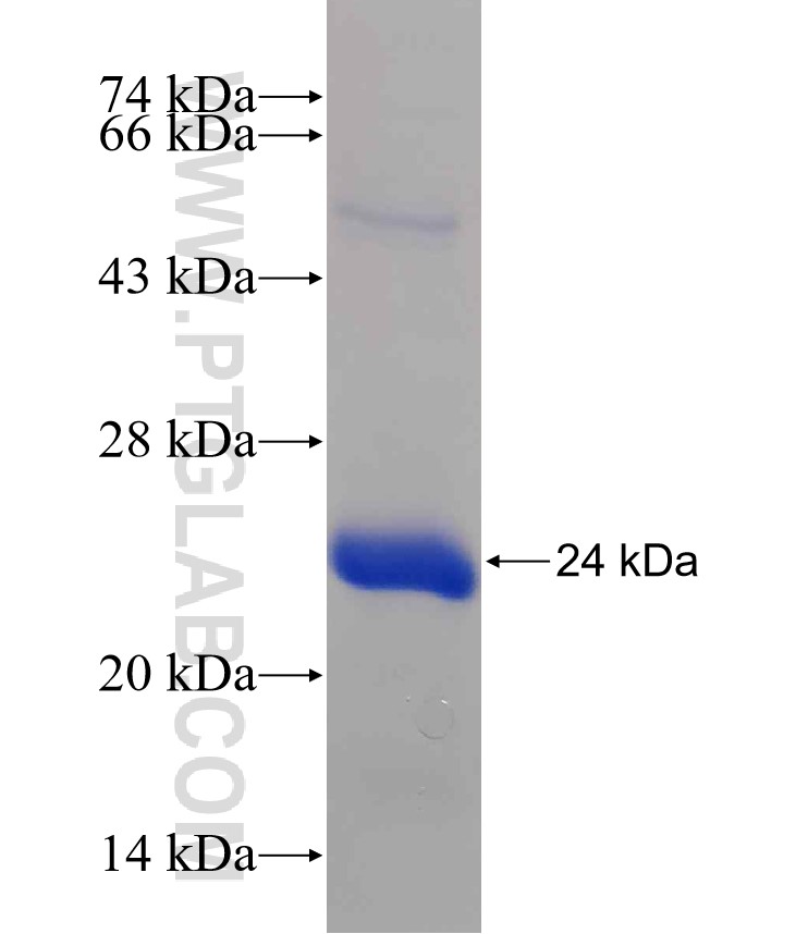 MCC fusion protein Ag30319 SDS-PAGE