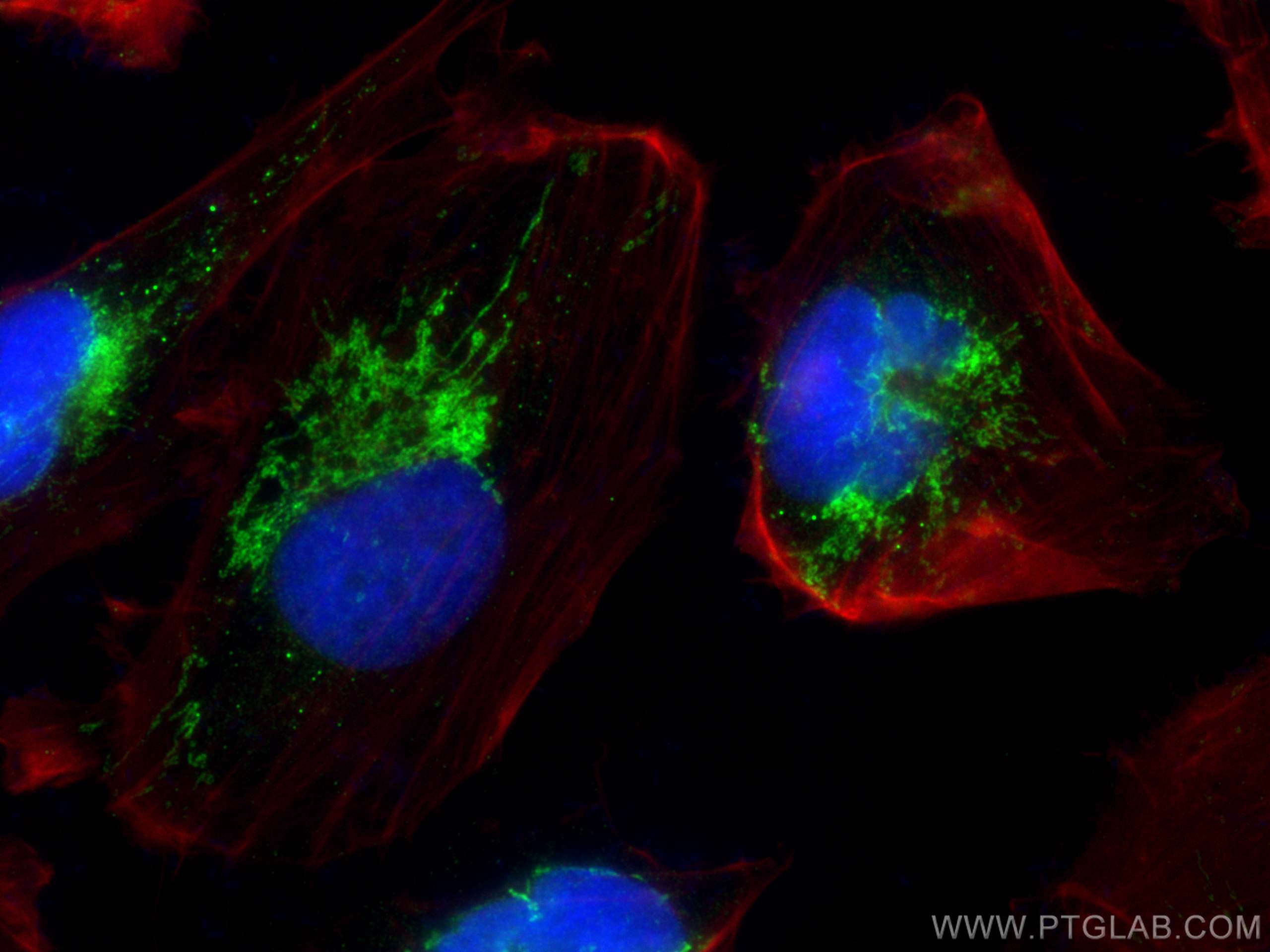 Immunofluorescence (IF) / fluorescent staining of U-251 cells using MCCC1 Polyclonal antibody (30081-1-AP)