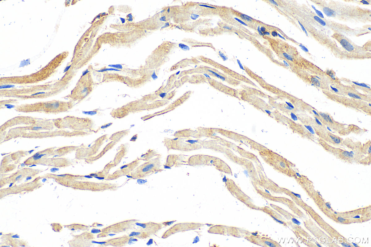 Immunohistochemistry (IHC) staining of mouse heart tissue using MCHR1 Polyclonal antibody (11656-2-AP)