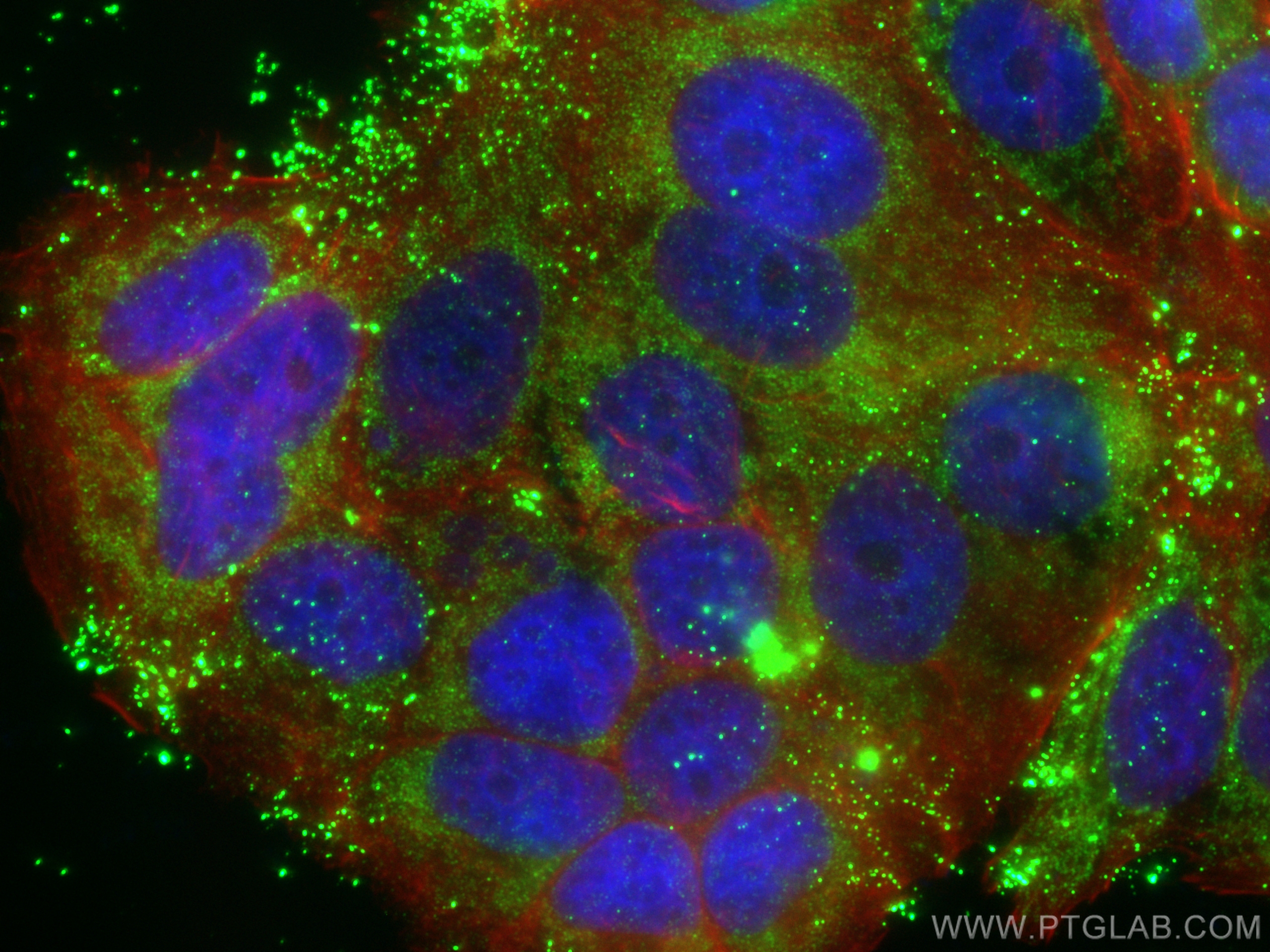 Immunofluorescence (IF) / fluorescent staining of MCF-7 cells using MCL1 Recombinant antibody (82695-4-RR)