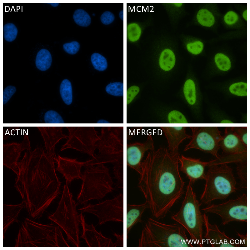 Immunofluorescence (IF) / fluorescent staining of HeLa cells using MCM2 Recombinant antibody (84511-2-RR)