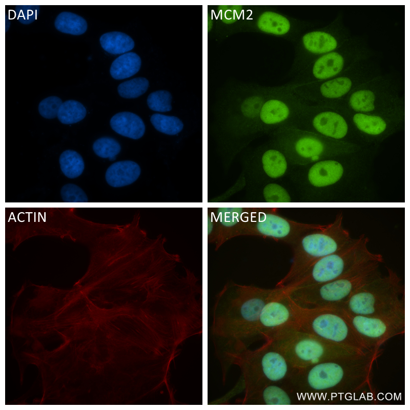 Immunofluorescence (IF) / fluorescent staining of MCF-7 cells using MCM2 Recombinant antibody (84511-2-RR)