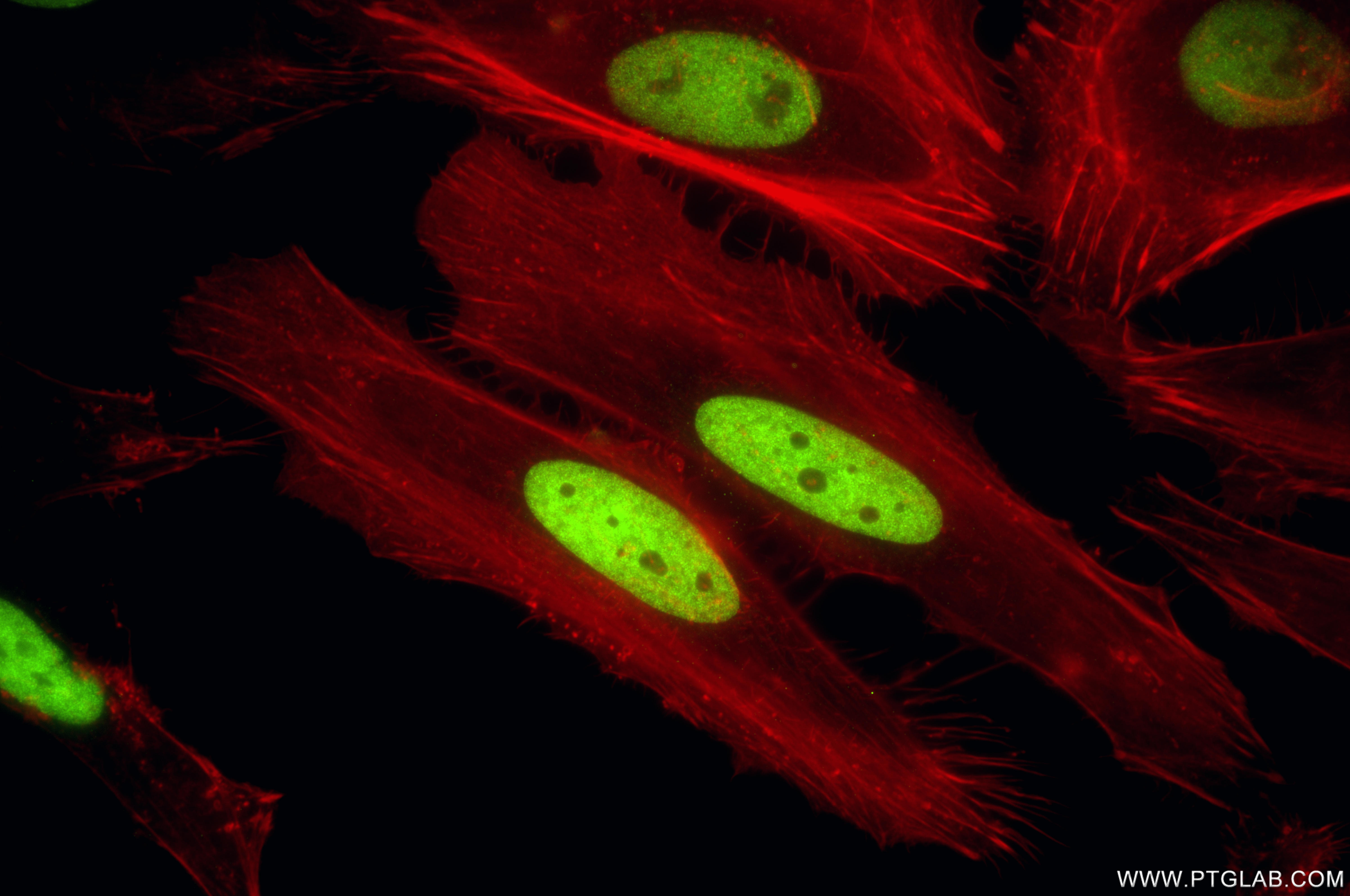 Immunofluorescence (IF) / fluorescent staining of HeLa cells using MCM2 Recombinant monoclonal antibody (84511-2-RR)