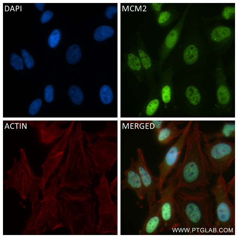 Immunofluorescence (IF) / fluorescent staining of HeLa cells using MCM2 Recombinant antibody (84511-5-RR)