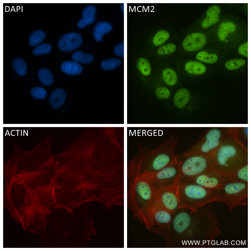 Immunofluorescence (IF) / fluorescent staining of MCF-7 cells using MCM2 Recombinant antibody (84511-5-RR)