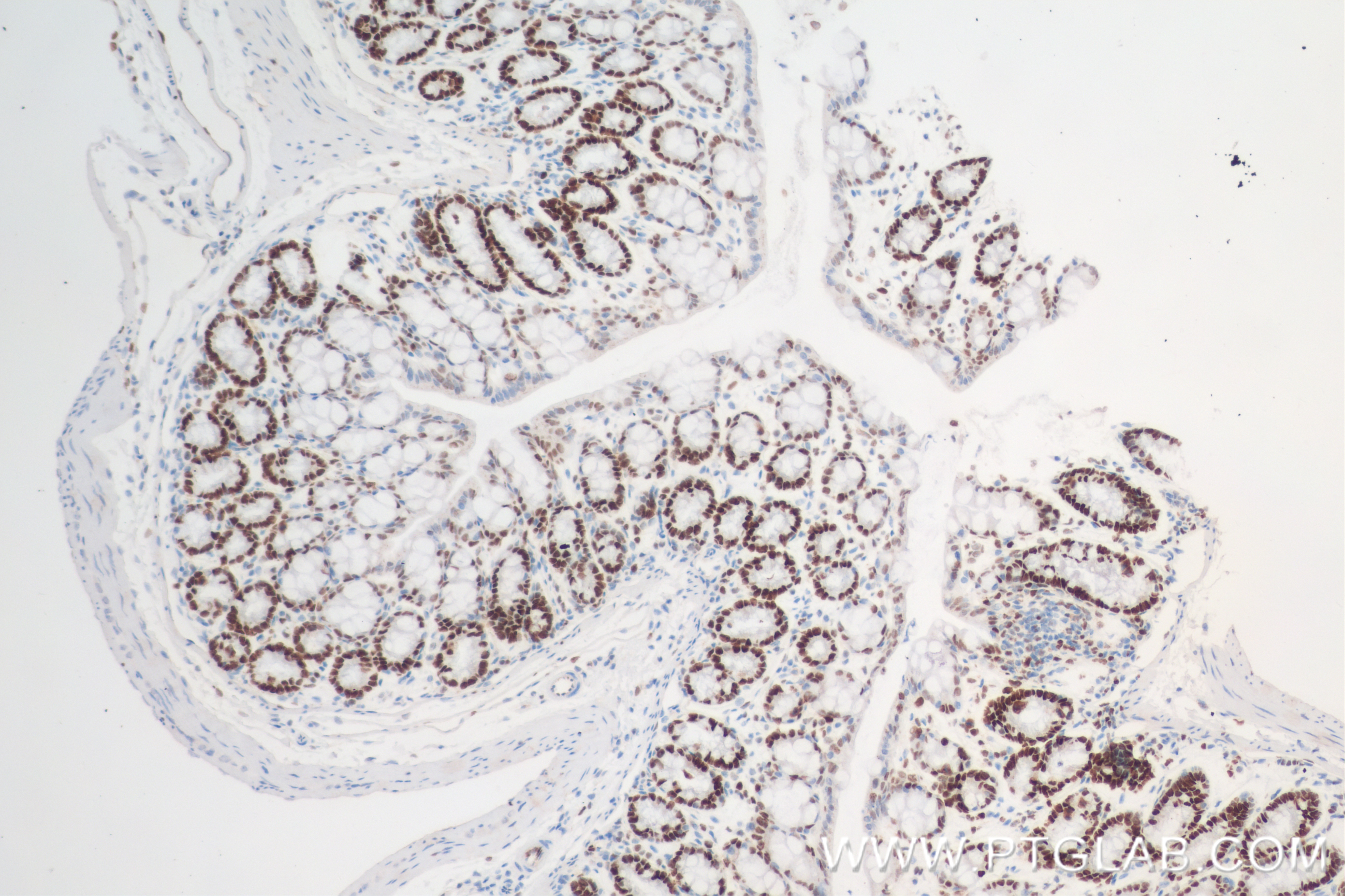 Immunohistochemistry (IHC) staining of mouse colon tissue using MCM2 Recombinant antibody (84511-5-RR)