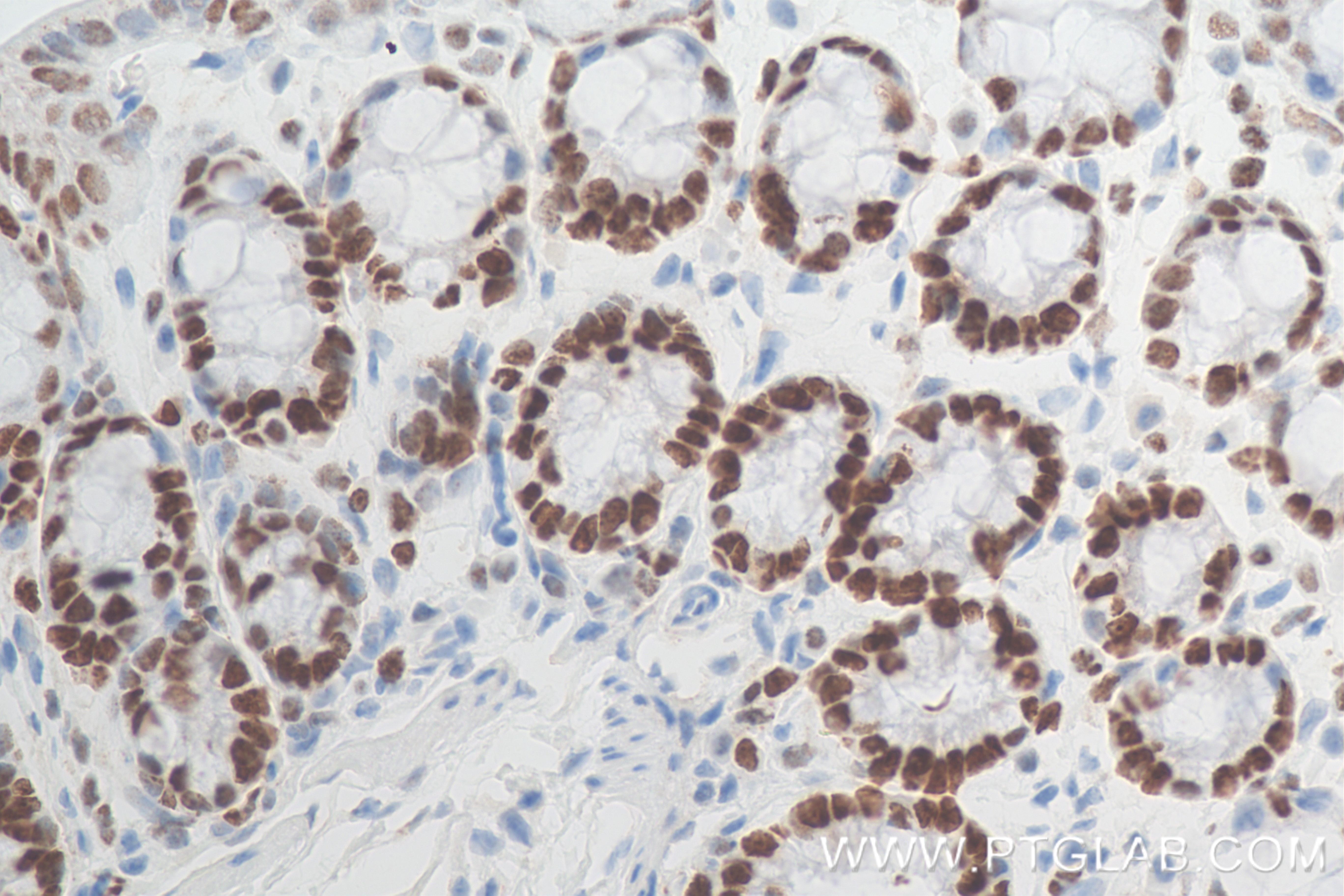 Immunohistochemistry (IHC) staining of mouse colon tissue using MCM2 Recombinant antibody (84511-5-RR)