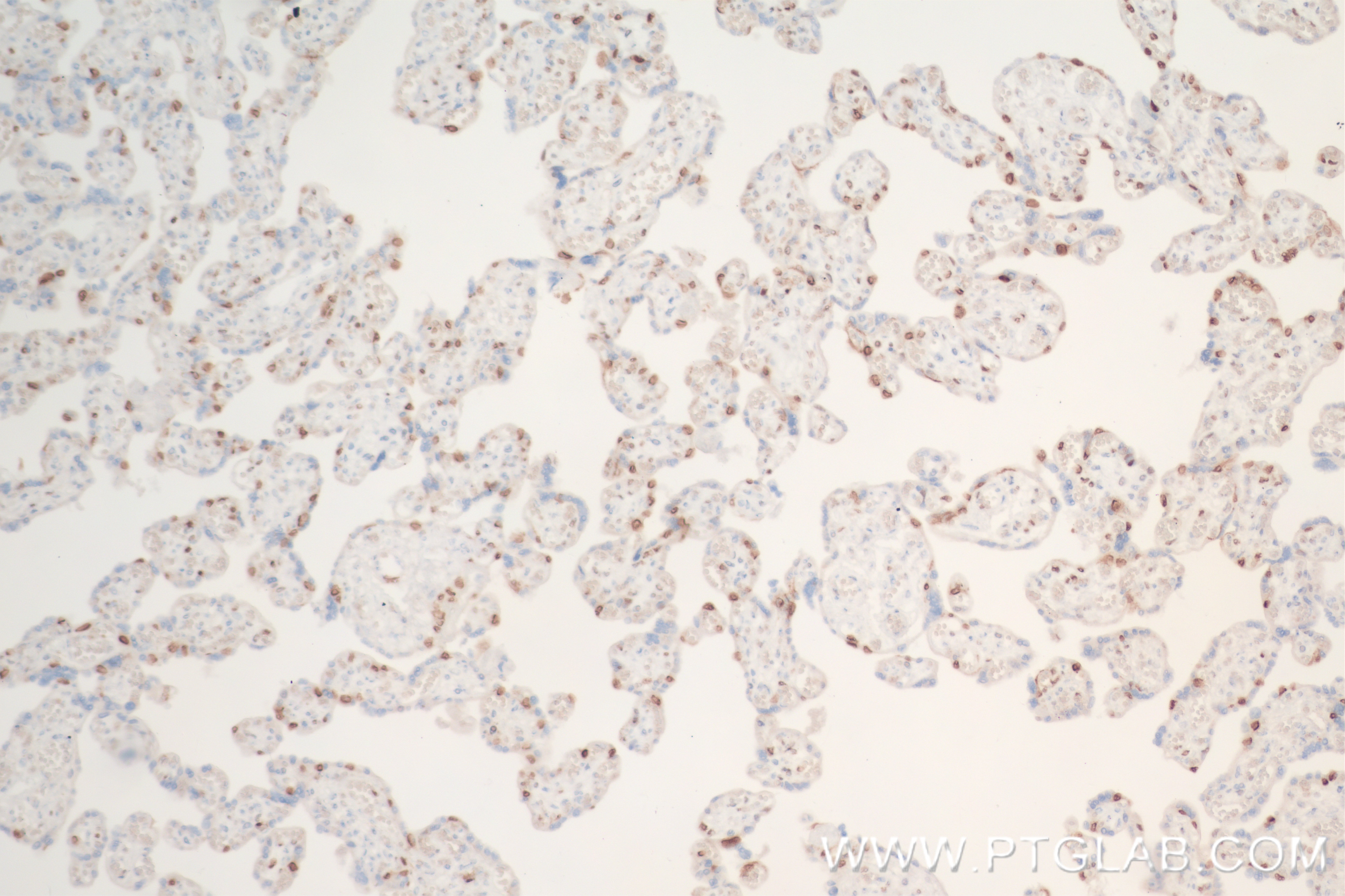 Immunohistochemistry (IHC) staining of human placenta tissue using MCM2 Recombinant antibody (84511-5-RR)