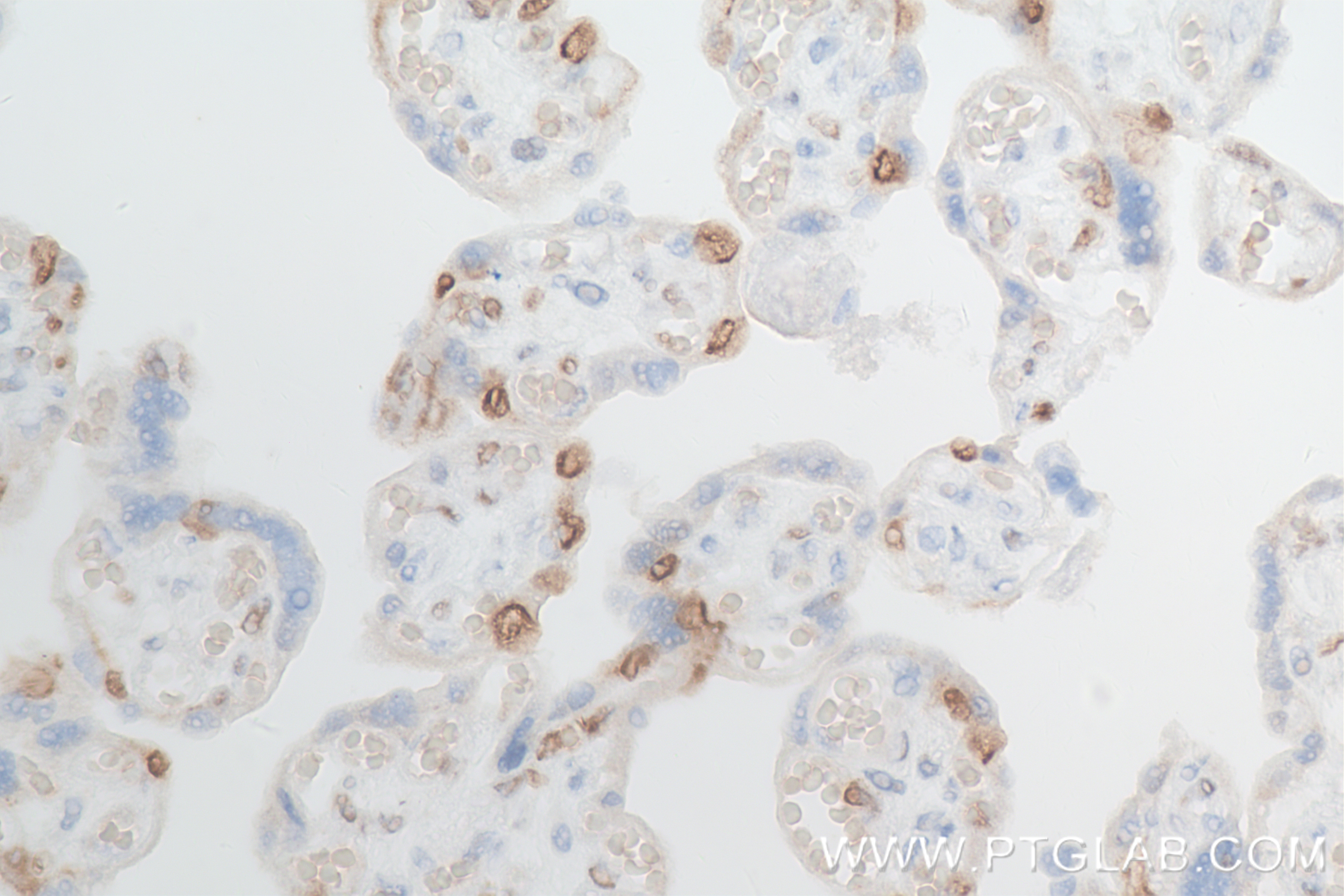 Immunohistochemistry (IHC) staining of human placenta tissue using MCM2 Recombinant antibody (84511-5-RR)