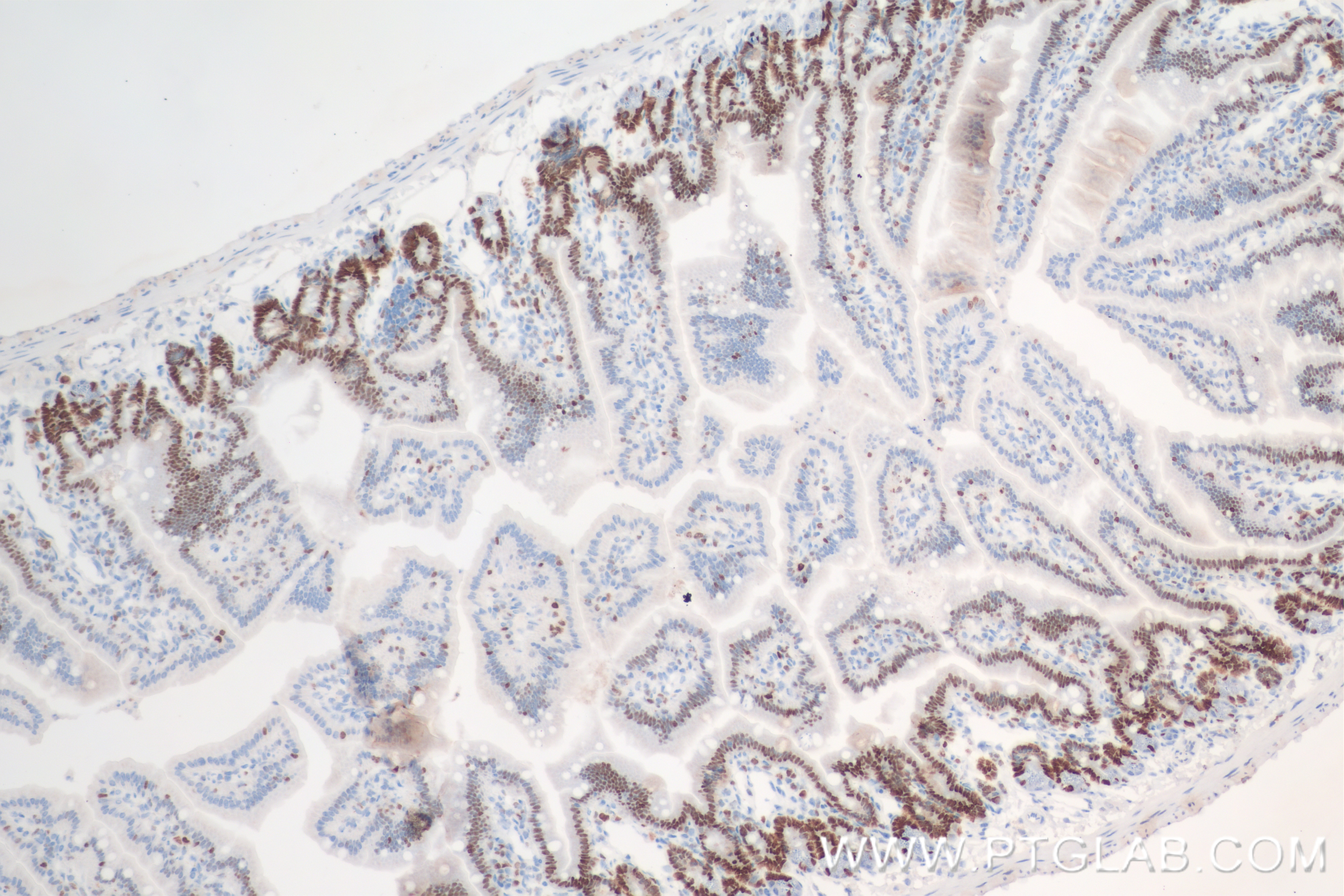 Immunohistochemistry (IHC) staining of mouse small intestine tissue using MCM2 Recombinant antibody (84511-5-RR)