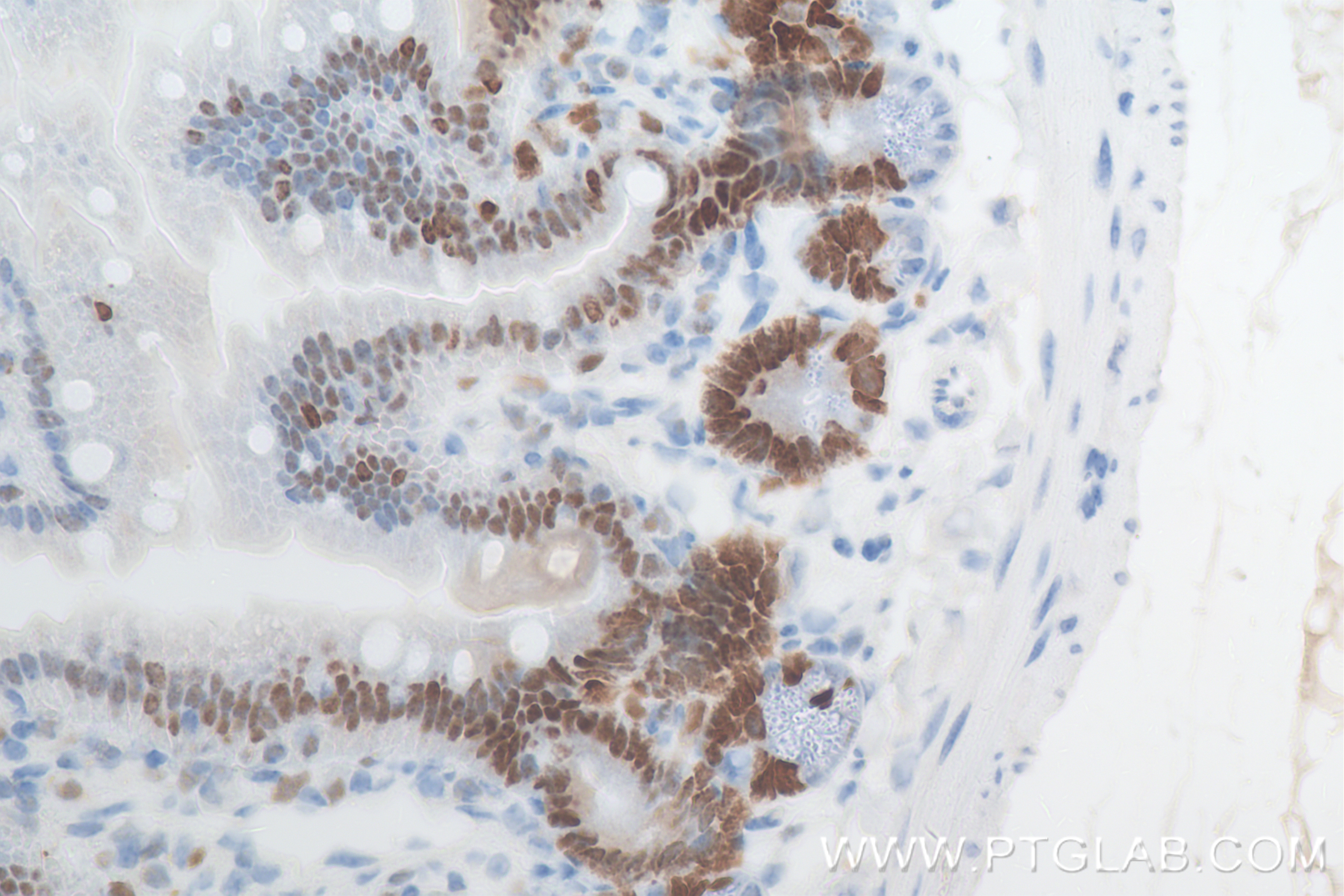 Immunohistochemistry (IHC) staining of mouse small intestine tissue using MCM2 Recombinant antibody (84511-5-RR)