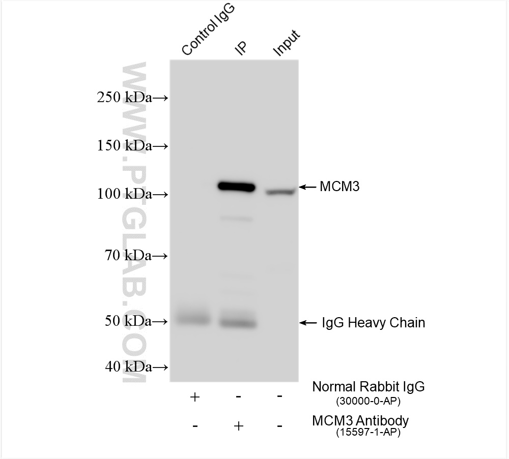 Immunoprecipitation (IP) experiment of HeLa cells using MCM3 Polyclonal antibody (15597-1-AP)