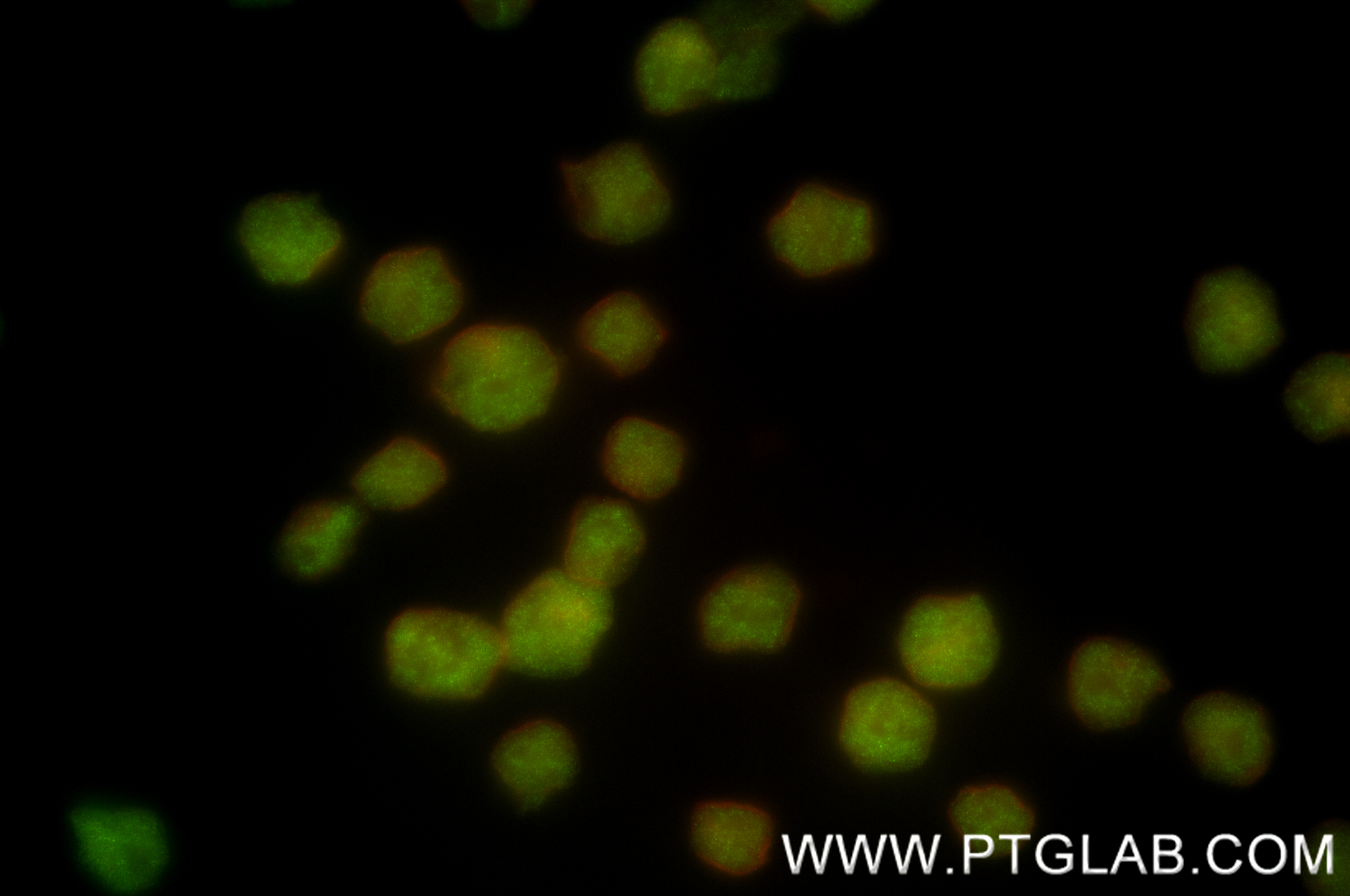 Immunofluorescence (IF) / fluorescent staining of Raji cells using MCM3 Recombinant antibody (84792-2-RR)