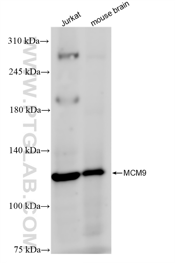 Western Blot (WB) analysis of various lysates using MCM9 Recombinant antibody (83587-1-RR)