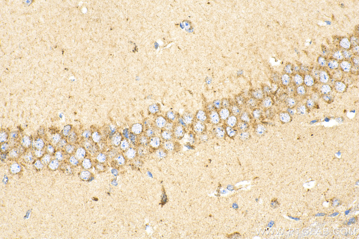 Immunohistochemistry (IHC) staining of mouse brain tissue using MCOLN1 Polyclonal antibody (15291-1-AP)