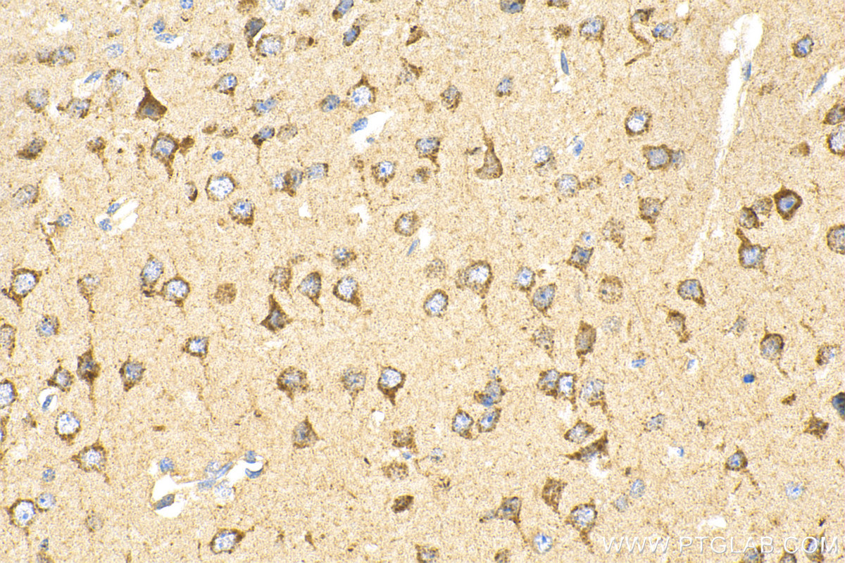 Immunohistochemistry (IHC) staining of mouse brain tissue using MCOLN1 Polyclonal antibody (15291-1-AP)