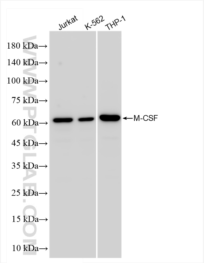 Western Blot (WB) analysis of various lysates using M-CSF Recombinant antibody (84481-4-RR)