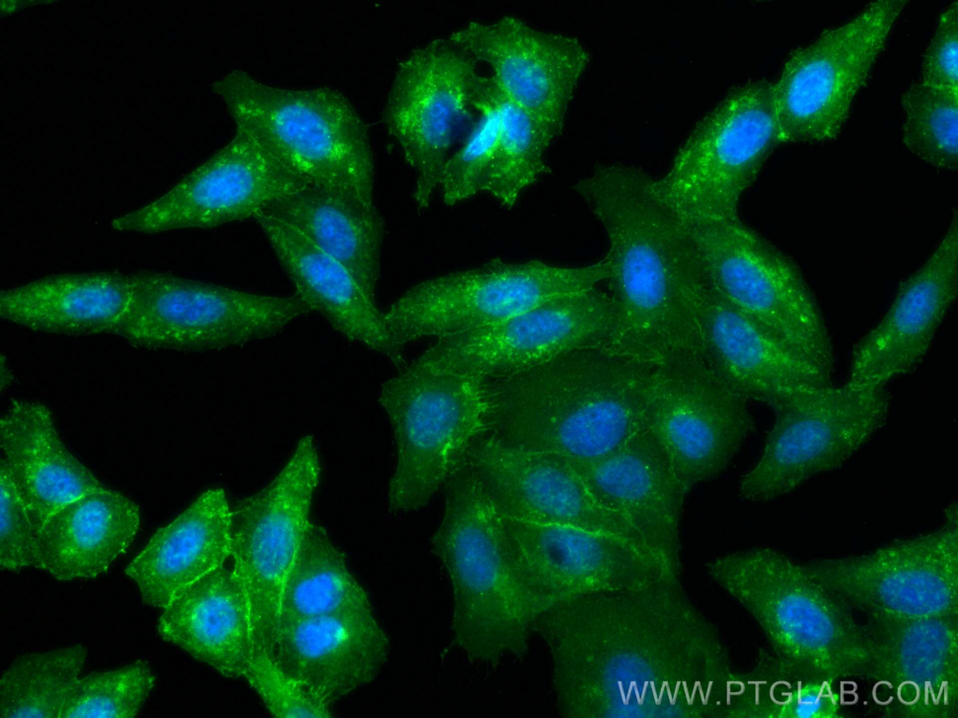 Immunofluorescence (IF) / fluorescent staining of HepG2 cells using MCT1 Polyclonal antibody (20139-1-AP)