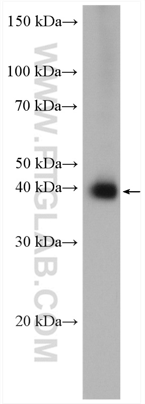 Western Blot (WB) analysis of BxPC-3 cells using MCT1 Polyclonal antibody (20139-1-AP)