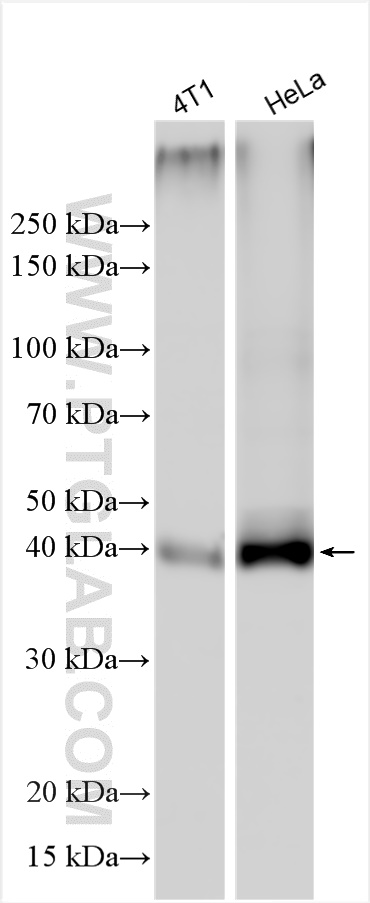 Western Blot (WB) analysis of various lysates using MCT1 Polyclonal antibody (20139-1-AP)