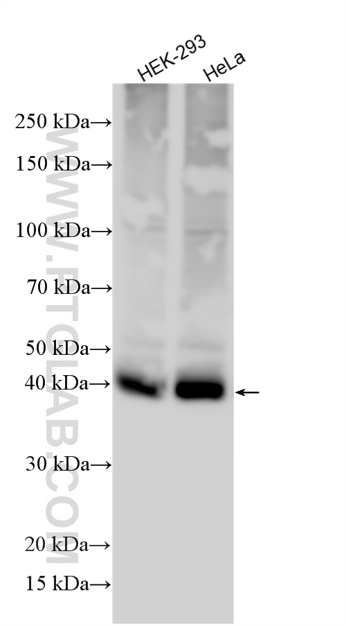 Western Blot (WB) analysis of various lysates using MCT1 Polyclonal antibody (20139-1-AP)