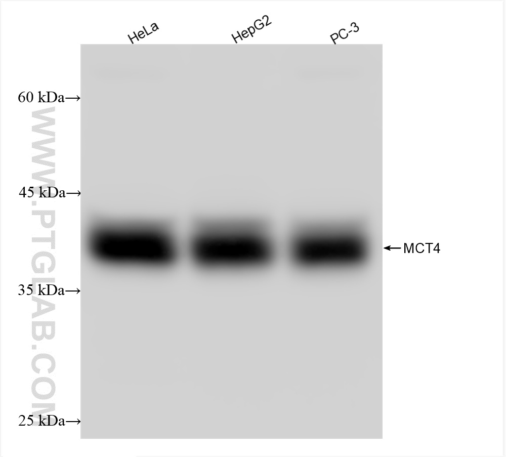 Western Blot (WB) analysis of various lysates using MCT4 Recombinant antibody (84797-4-RR)