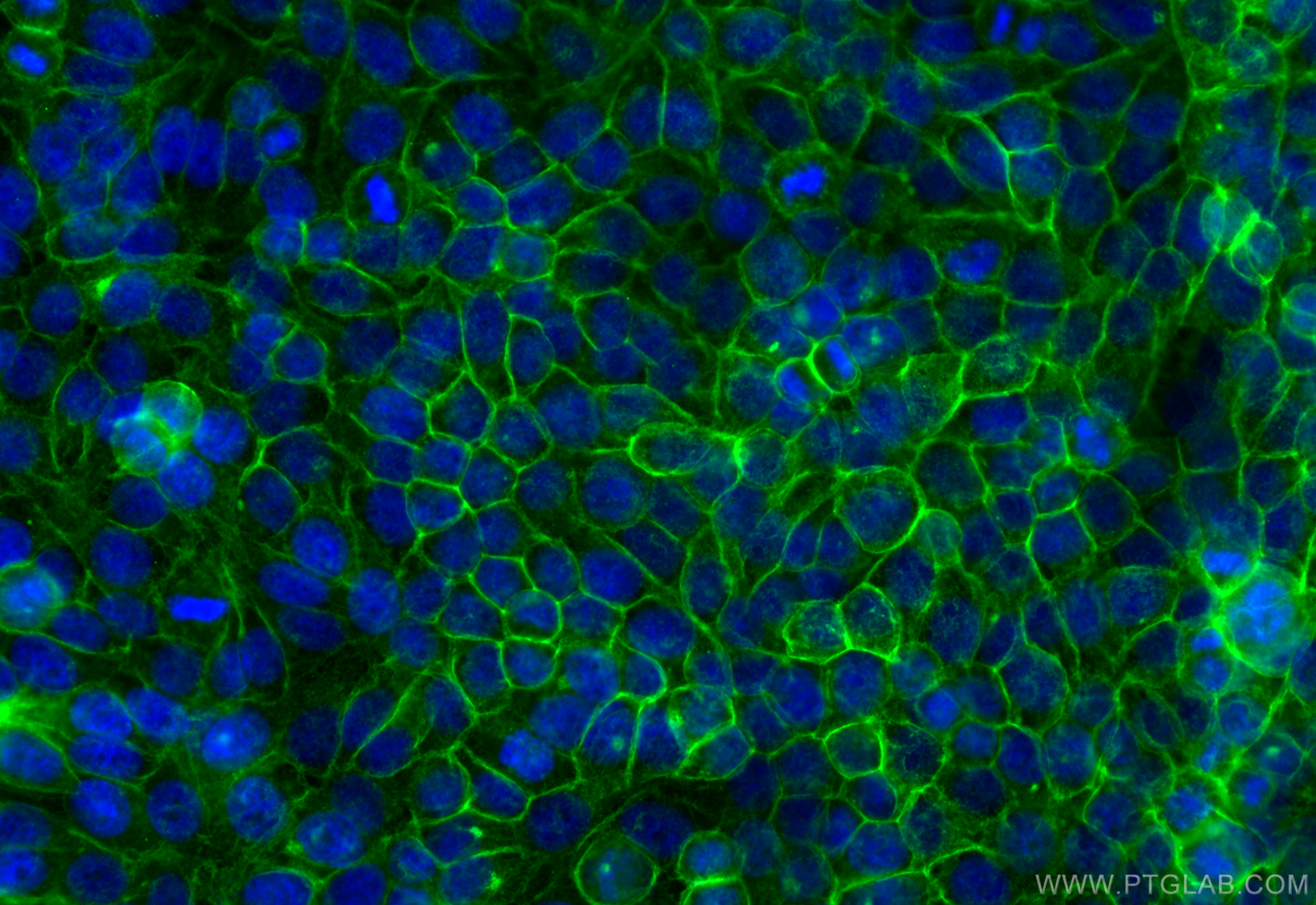 Immunofluorescence (IF) / fluorescent staining of HepG2 cells using CoraLite® Plus 488-conjugated MCT4 Polyclonal anti (CL488-22787)