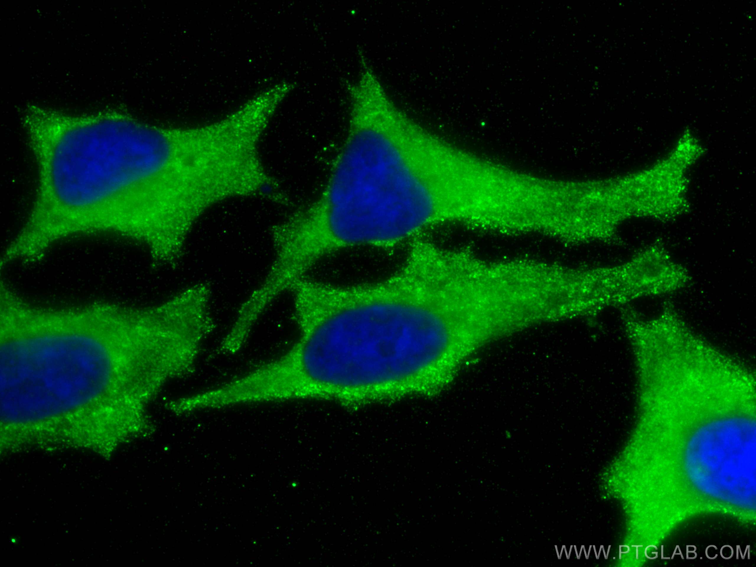 Immunofluorescence (IF) / fluorescent staining of HeLa cells using MCTS1 Monoclonal antibody (68360-1-Ig)