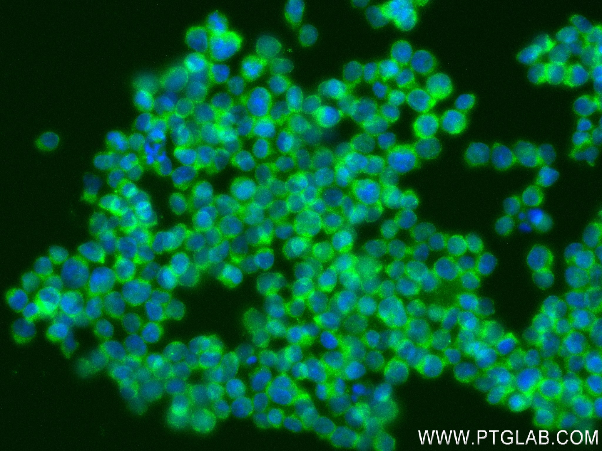 Immunofluorescence (IF) / fluorescent staining of Jurkat cells using MCTS1 Recombinant antibody (84312-5-RR)