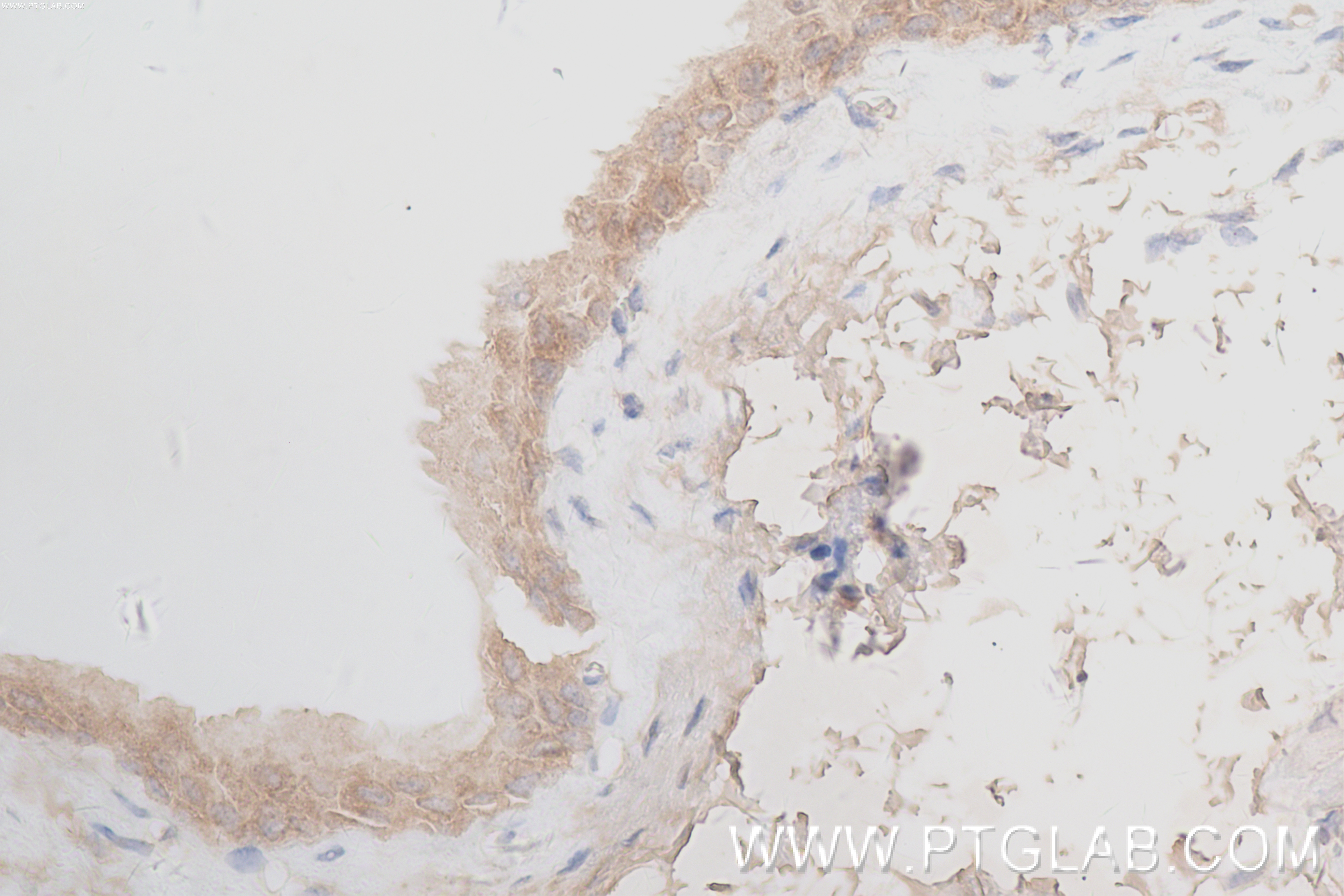 Immunohistochemistry (IHC) staining of mouse bladder tissue using MCTS1 Recombinant antibody (84312-5-RR)