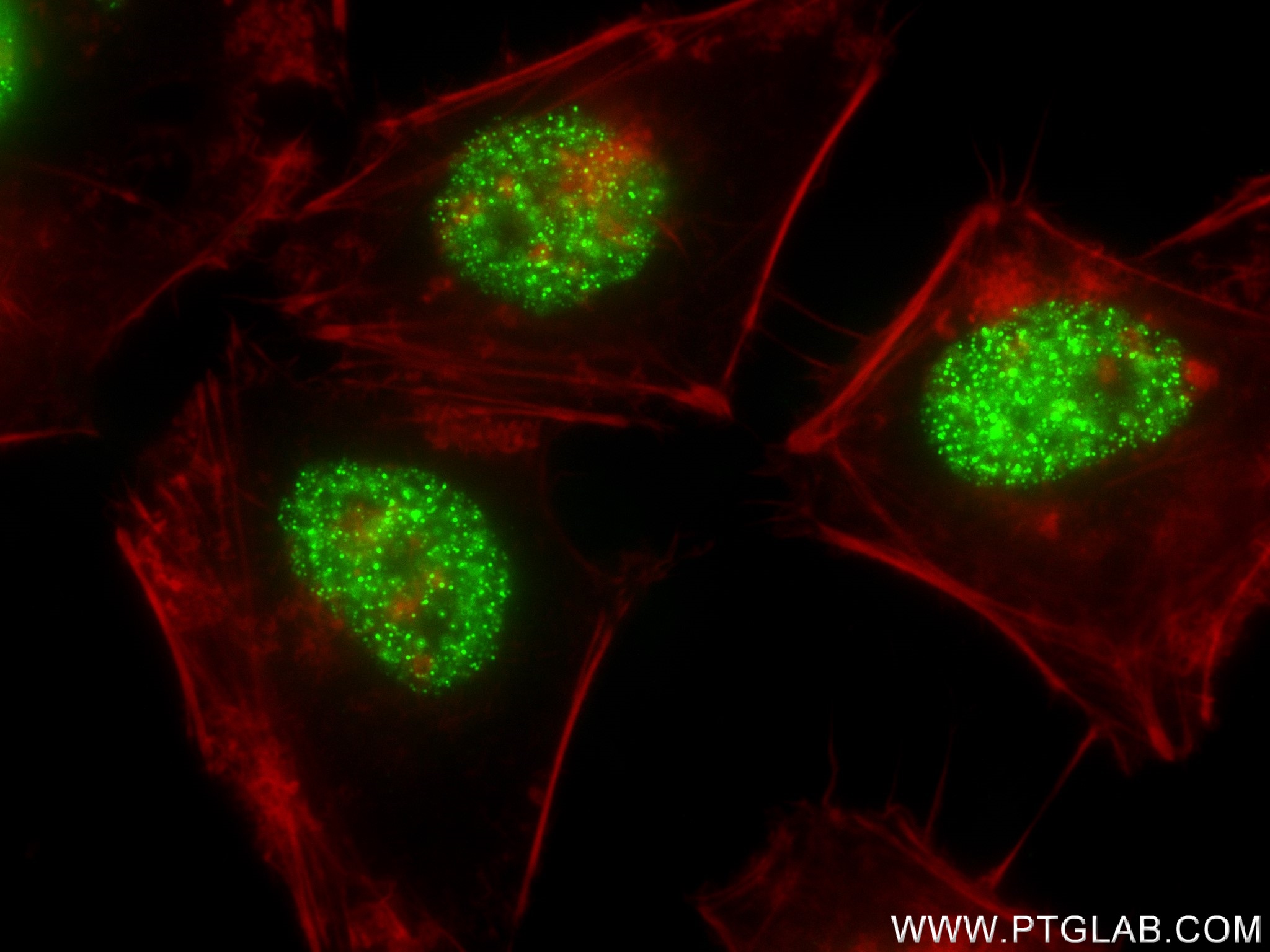 Immunofluorescence (IF) / fluorescent staining of HeLa cells using MDC1 Recombinant antibody (83496-1-RR)