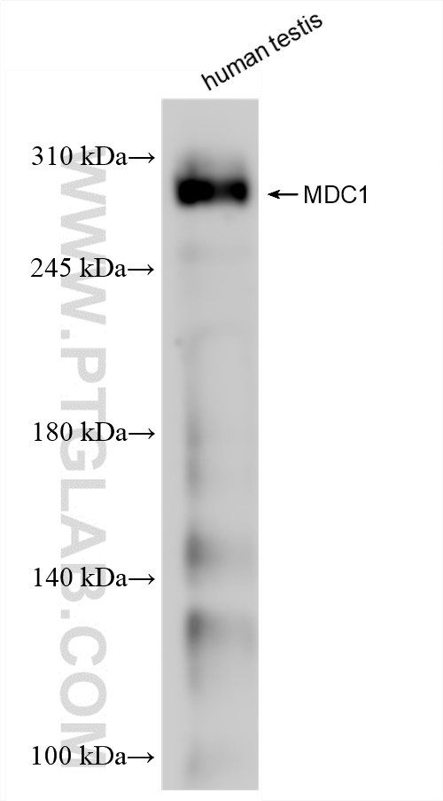 Western Blot (WB) analysis of human testis tissue using MDC1 Recombinant antibody (83496-1-RR)