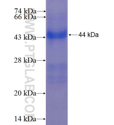 MDGA1 fusion protein Ag22704 SDS-PAGE