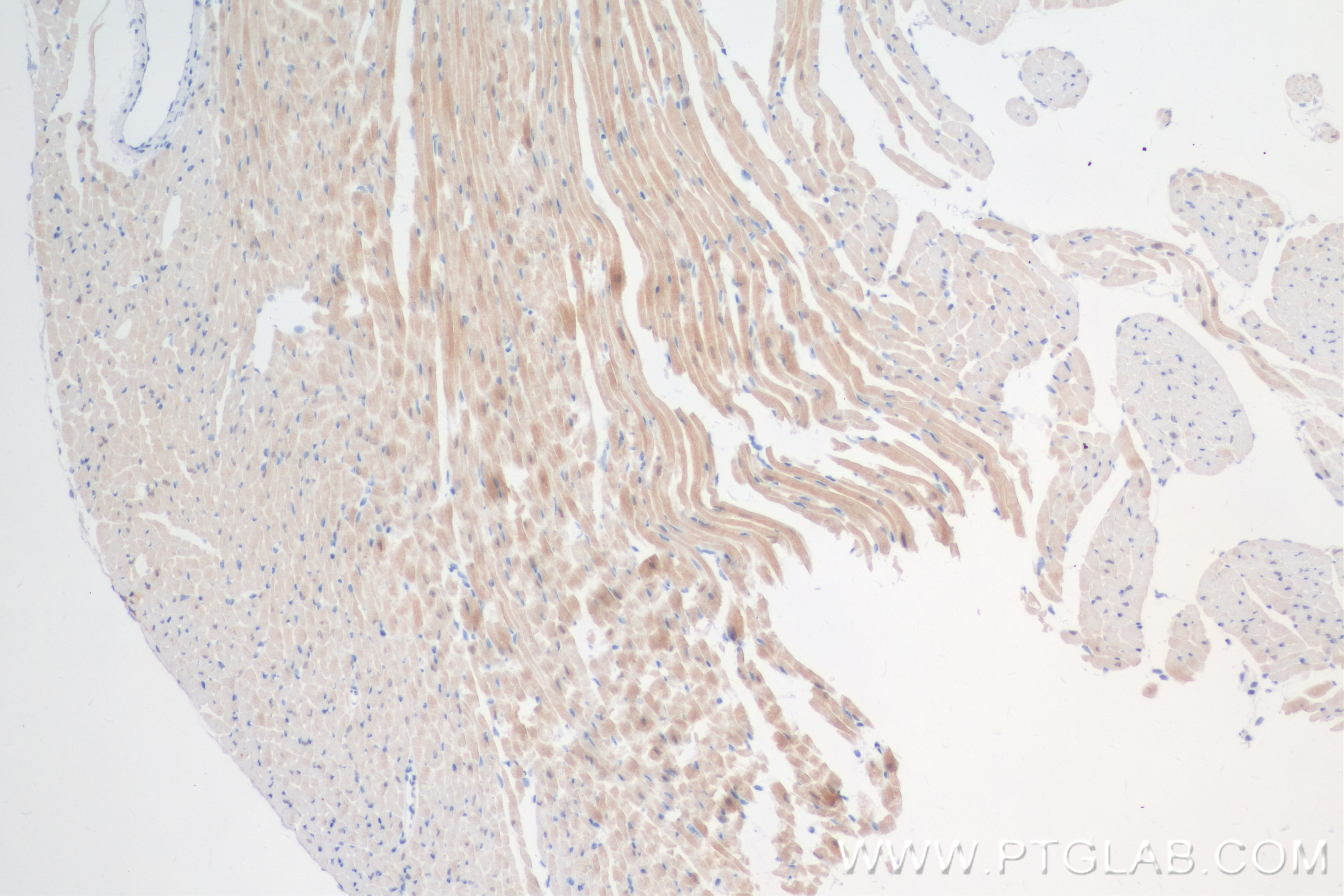 Immunohistochemistry (IHC) staining of mouse heart tissue using MDH1 Recombinant antibody (84576-4-RR)