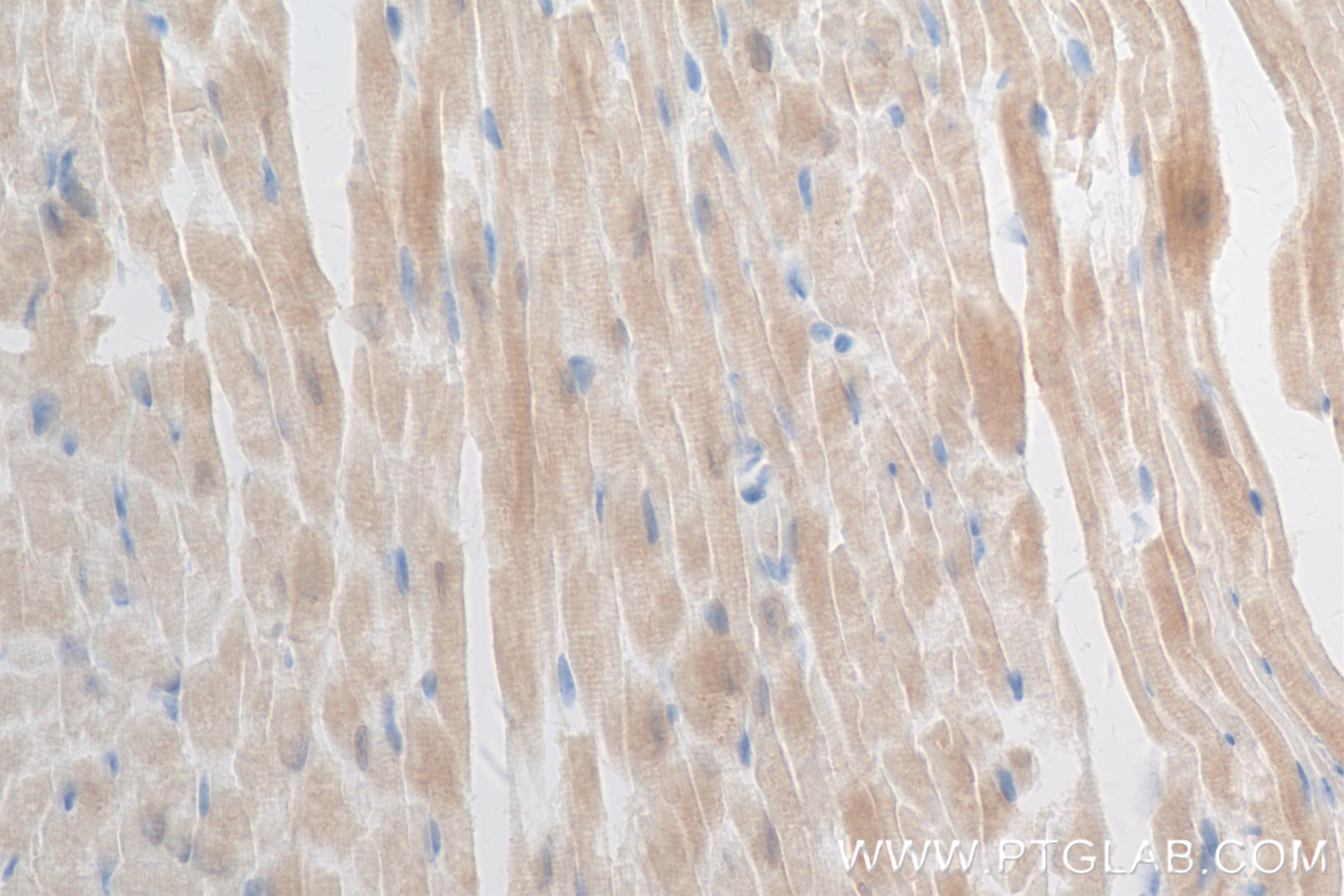 Immunohistochemistry (IHC) staining of mouse heart tissue using MDH1 Recombinant antibody (84576-4-RR)