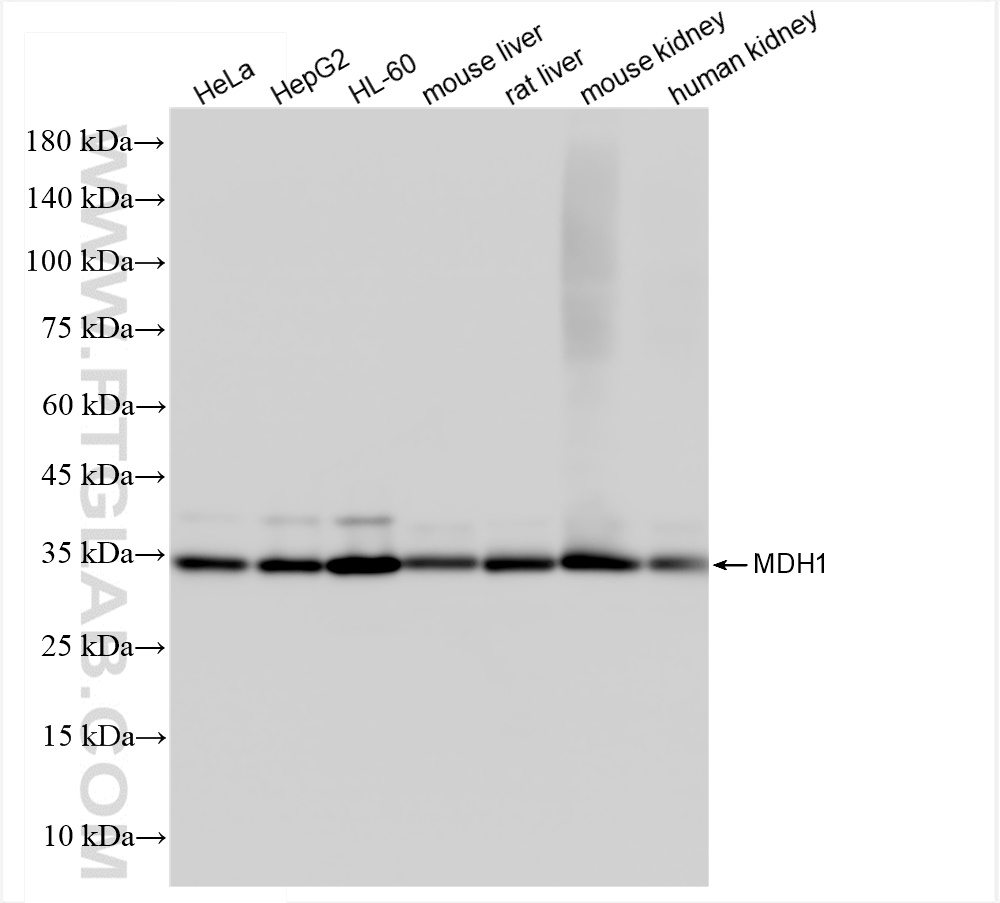 MDH1