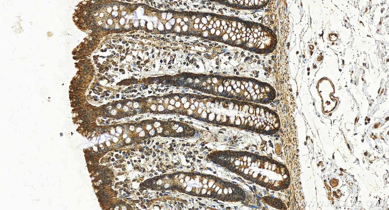 Immunohistochemistry (IHC) staining of human colon tissue using MDH2 Polyclonal antibody (15462-1-AP)