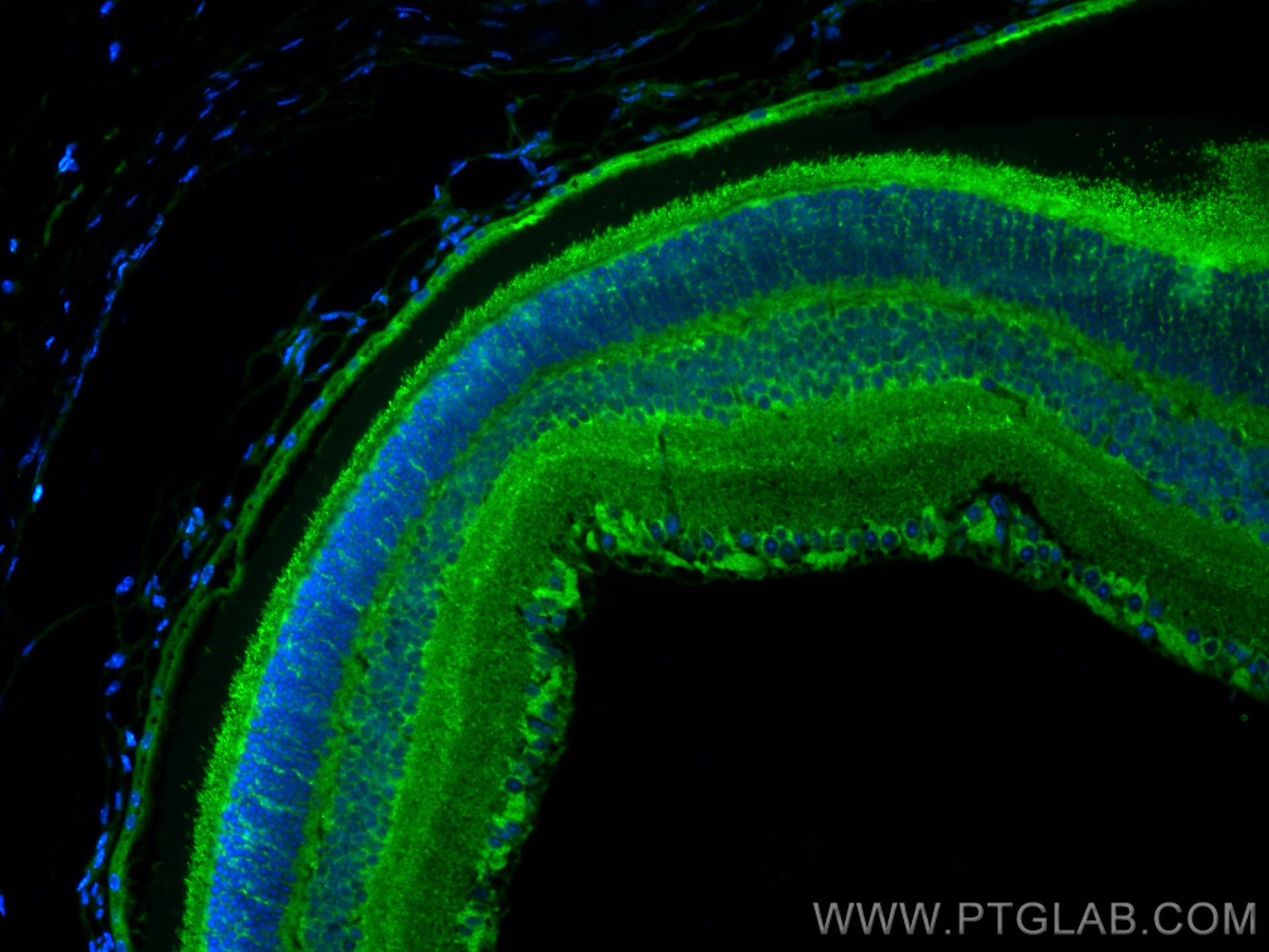 Immunofluorescence (IF) / fluorescent staining of mouse eye tissue using MDM1 Polyclonal antibody (17575-1-AP)