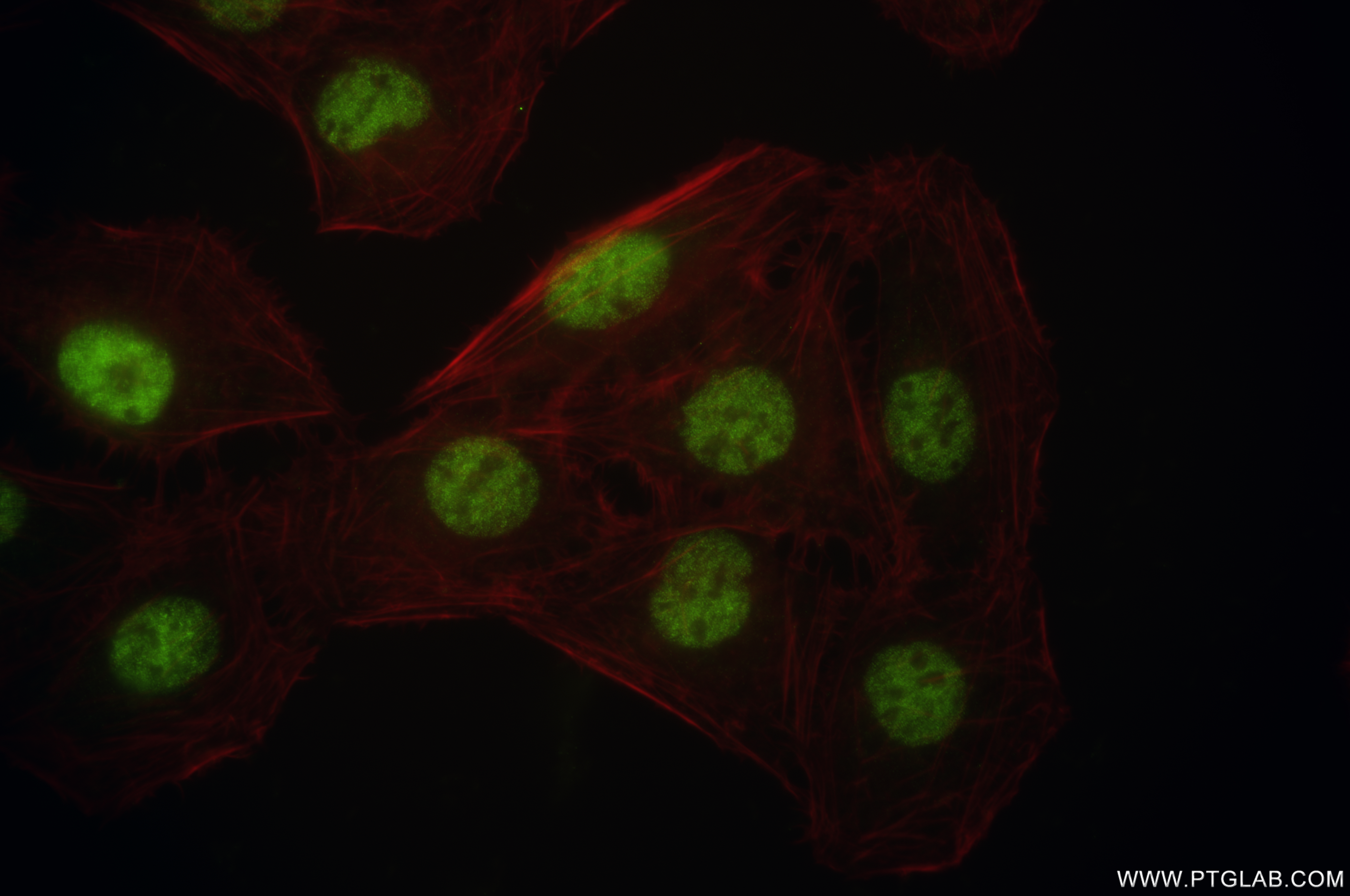 Immunofluorescence (IF) / fluorescent staining of U2OS cells using MDMX/MDM4 Recombinant antibody (84534-6-RR)